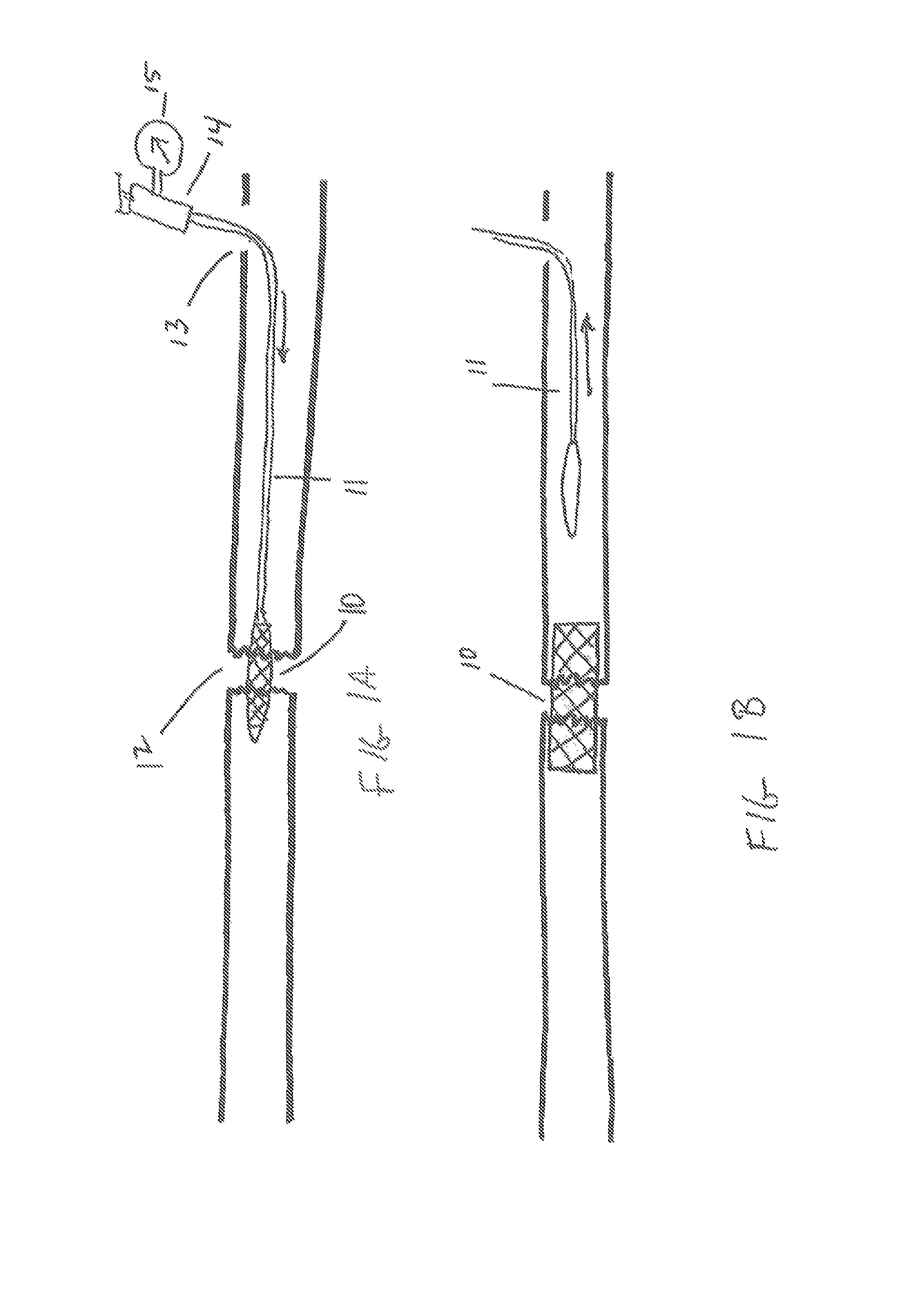 Method and devices for the treatment of nasal sinus disorders
