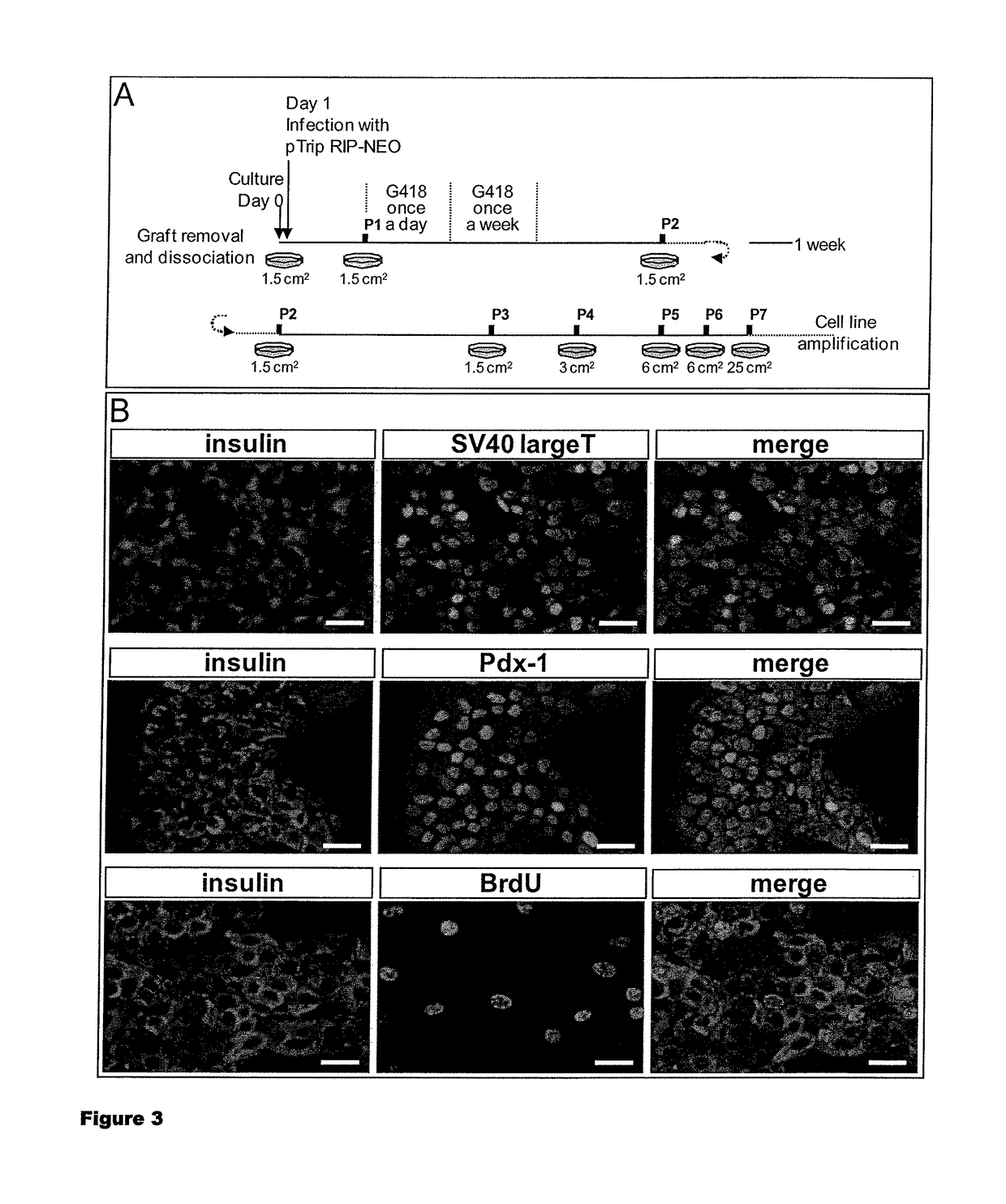 Human pancreatic beta cell lines for diagnostic of diabetes