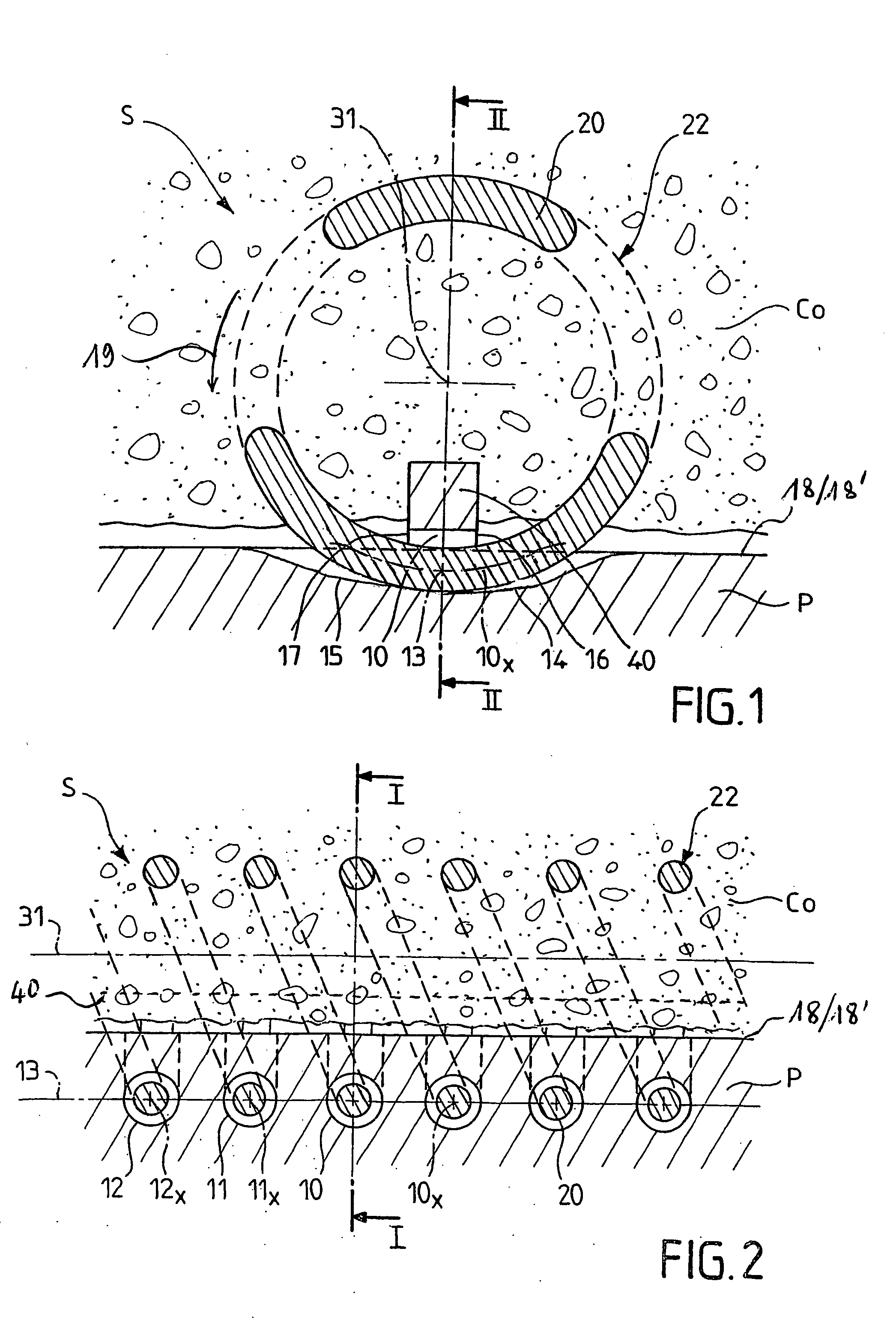 System for fixing a part to a bone element