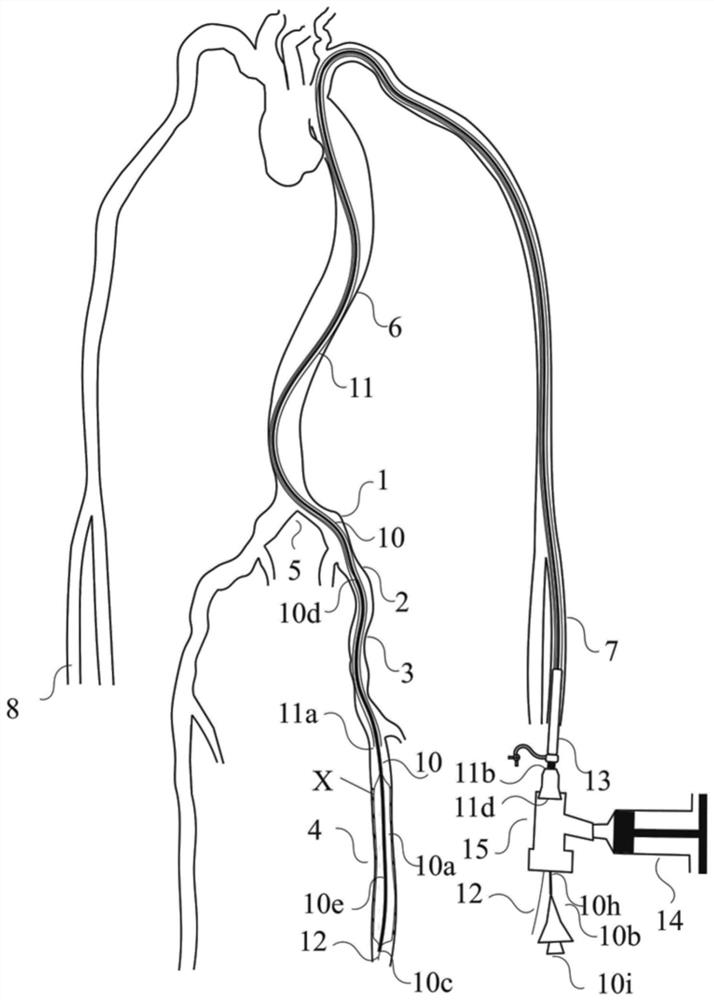 Treatment method, separation method, and filter assembly