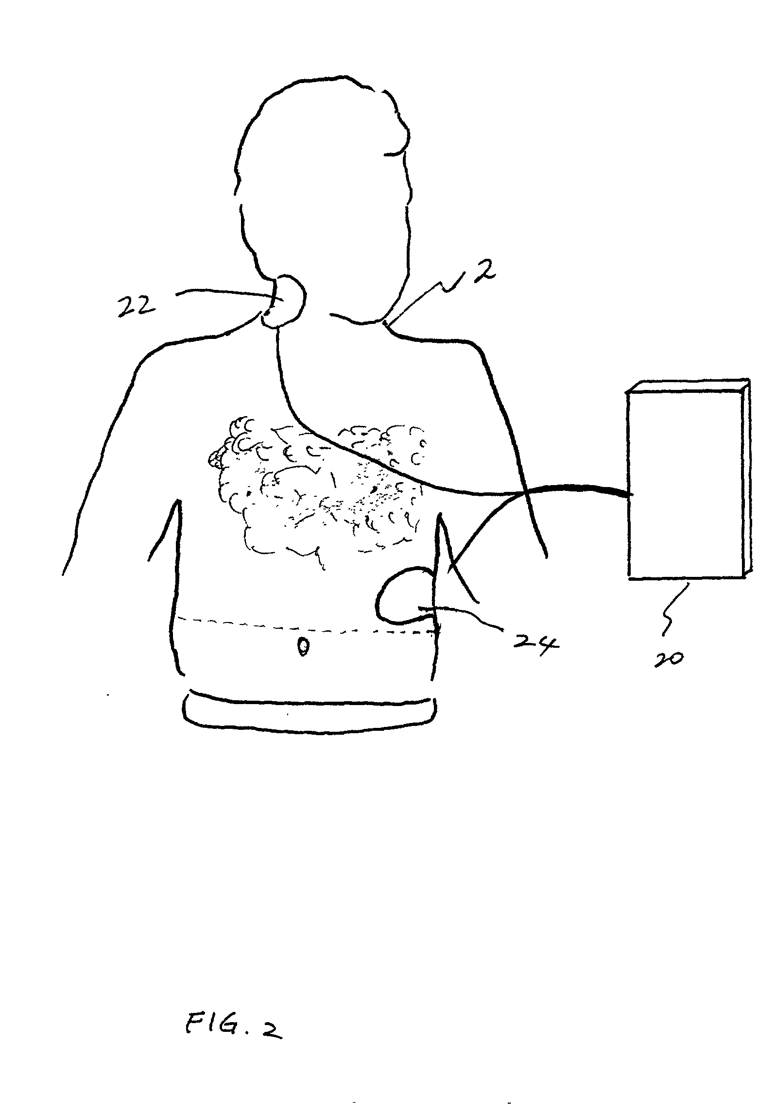 Defibrillation system and method designed for rapid attachment