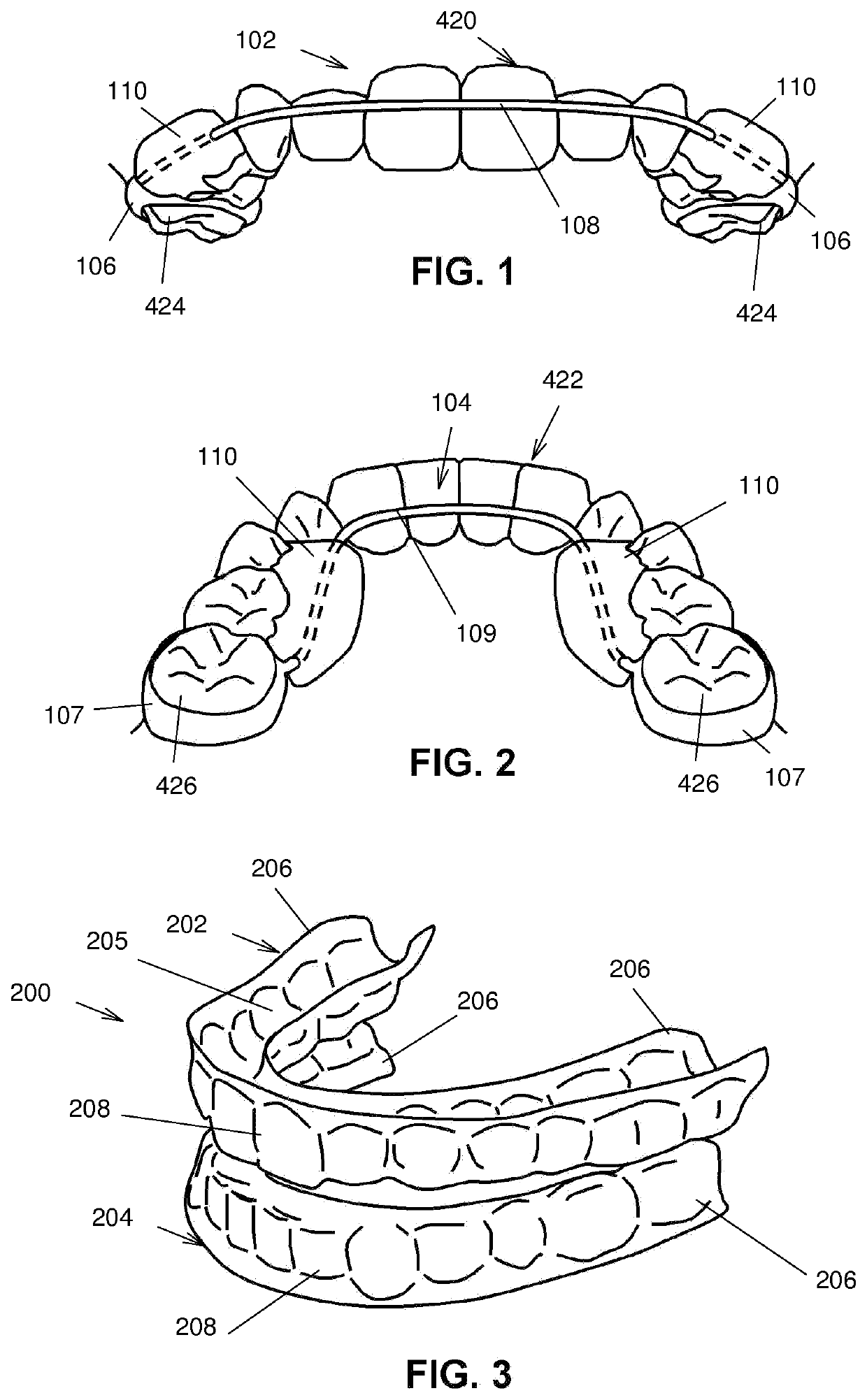 Intraoral device and method of using same