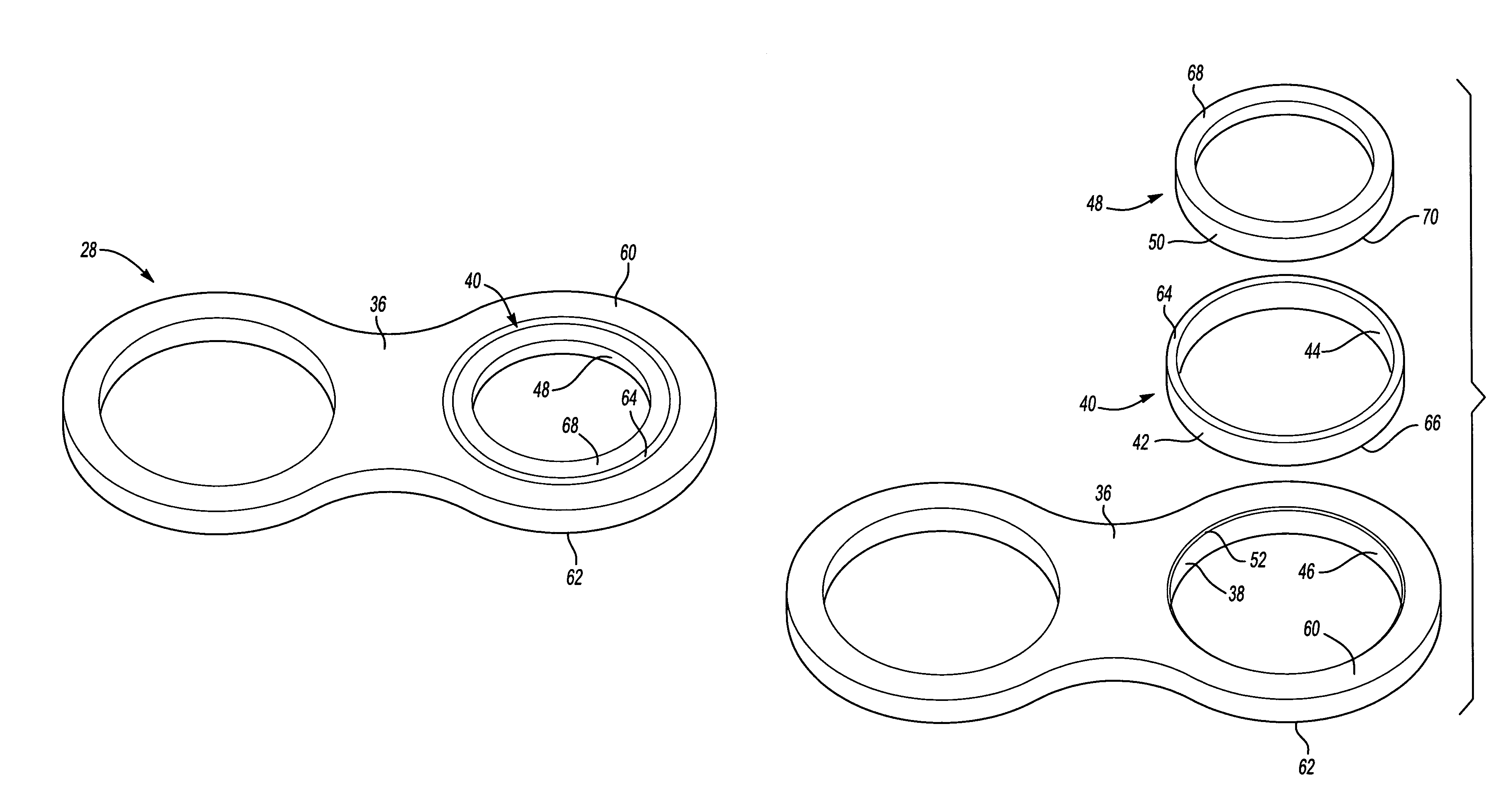 Engine mount bearing sleeve repair