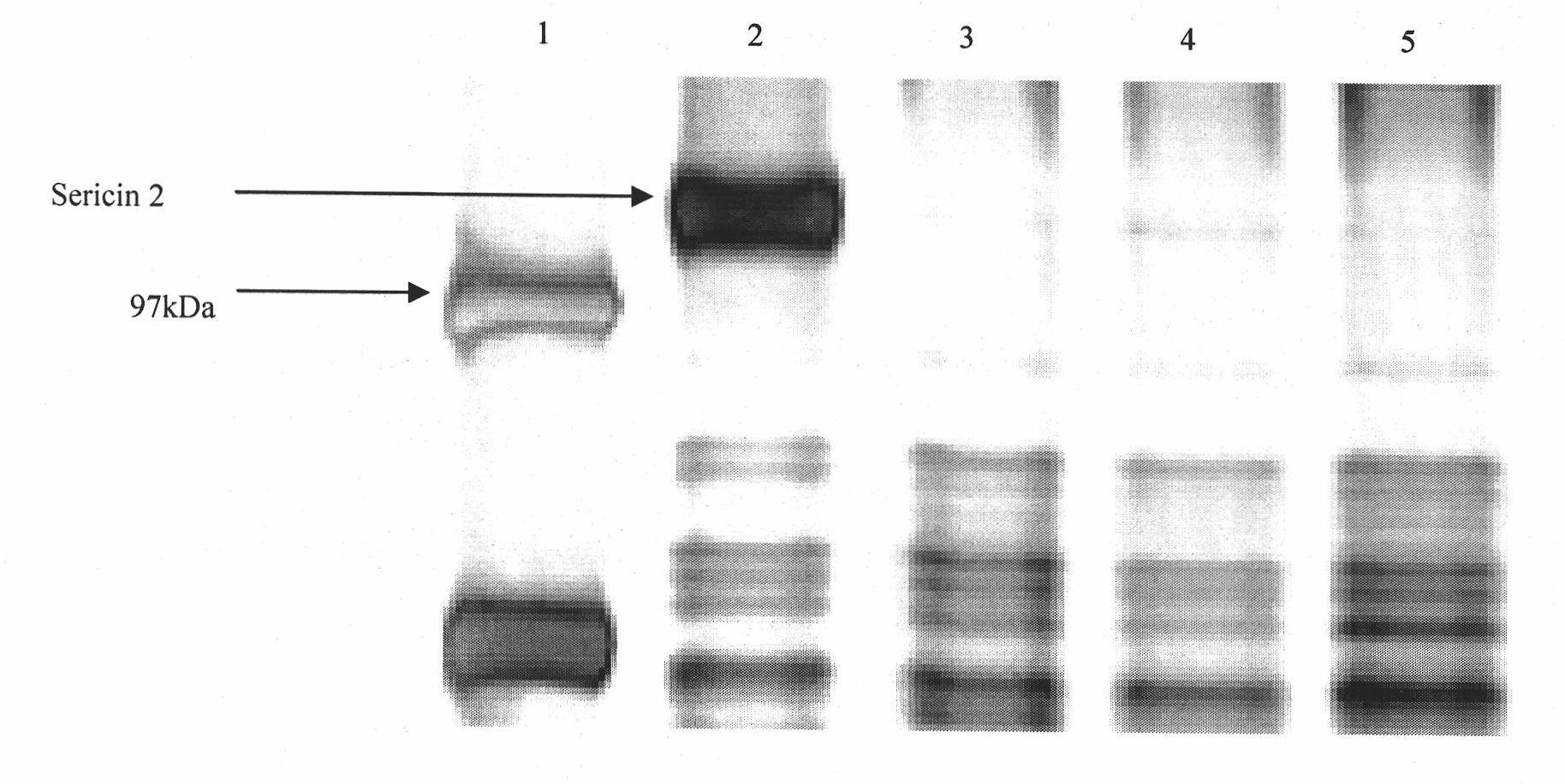 Method for selecting high-reelability bombyx mori cocoons by utilizing protein molecular marker