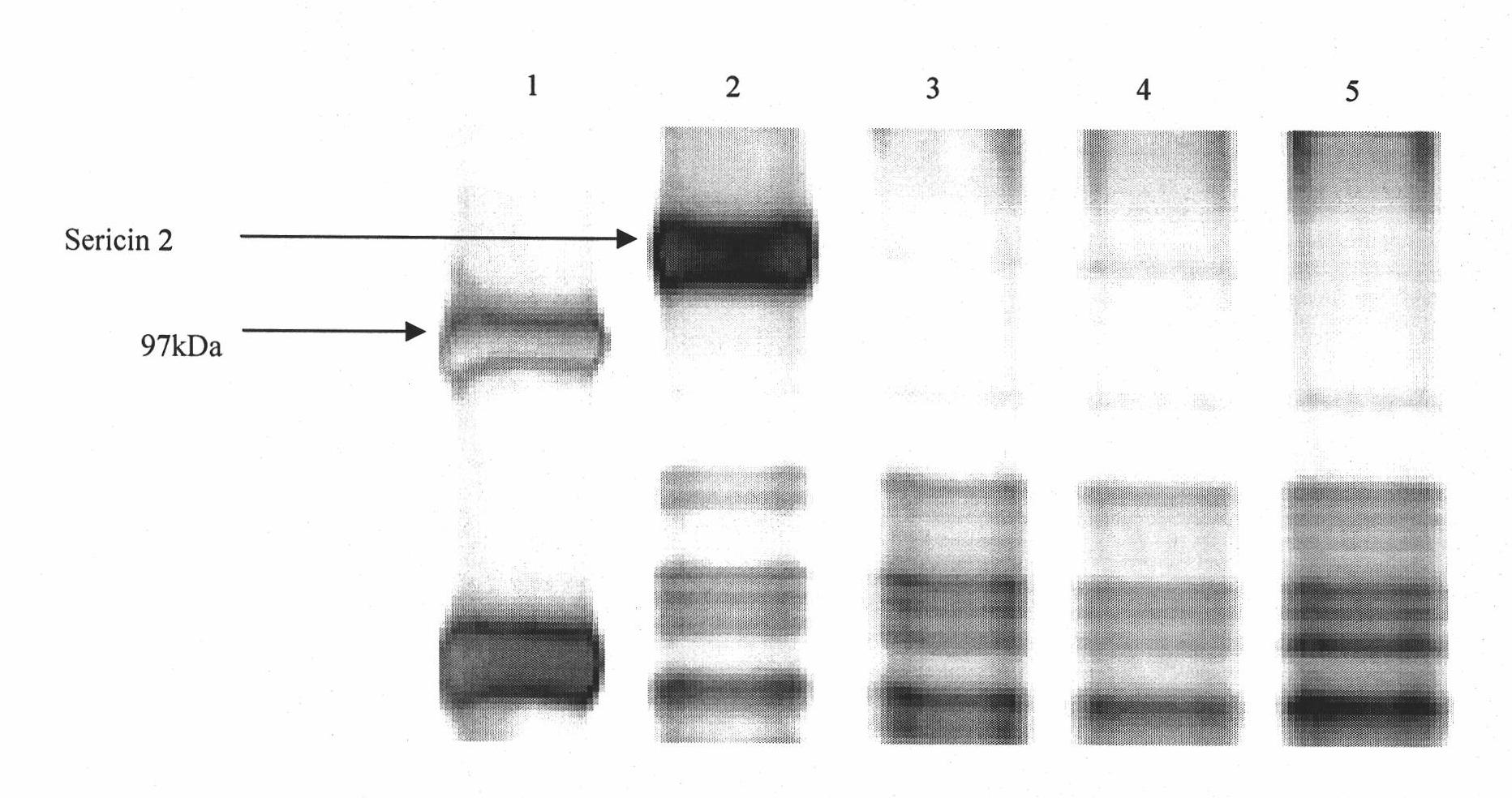 Method for selecting high-reelability bombyx mori cocoons by utilizing protein molecular marker