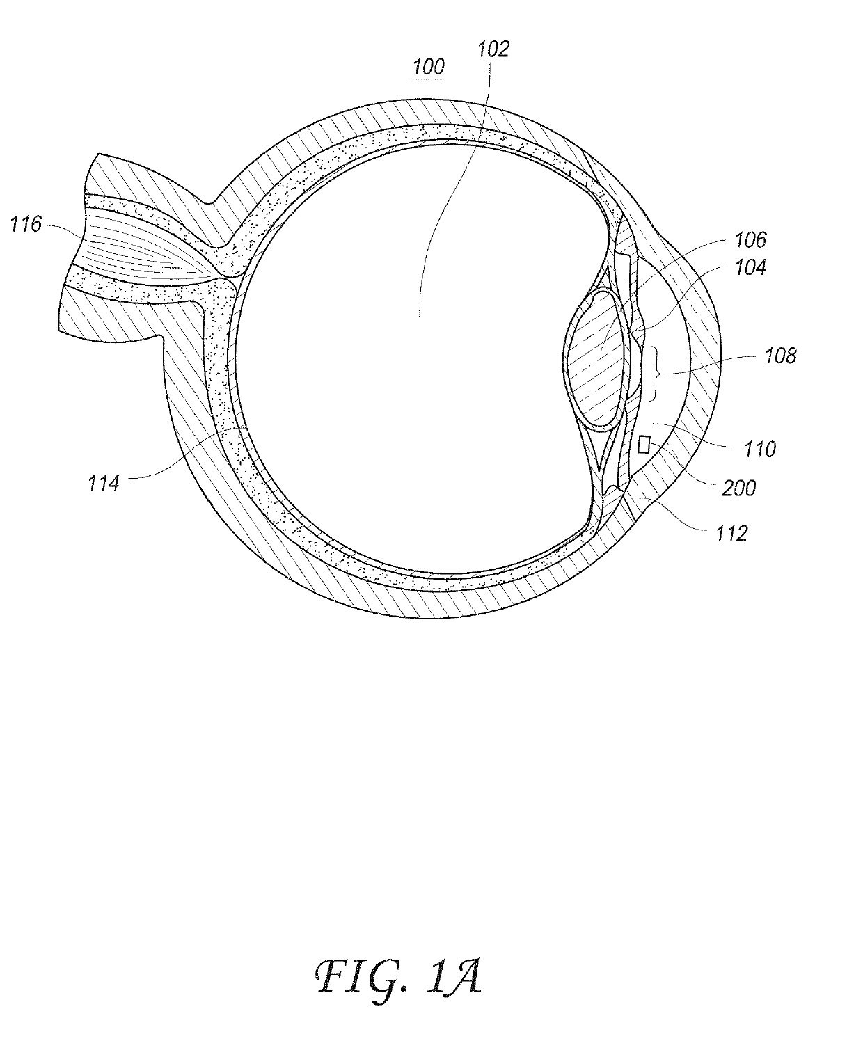 Intraocular physiological sensor