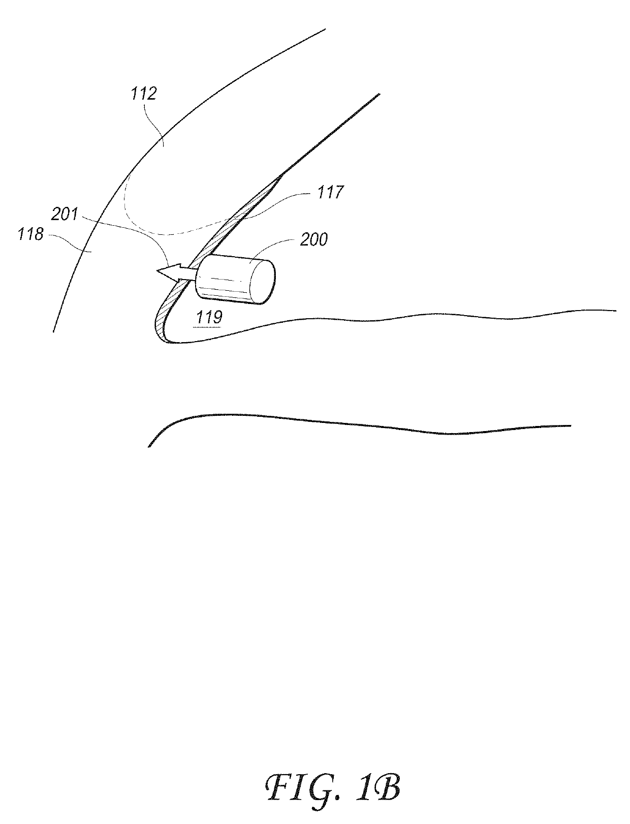 Intraocular physiological sensor