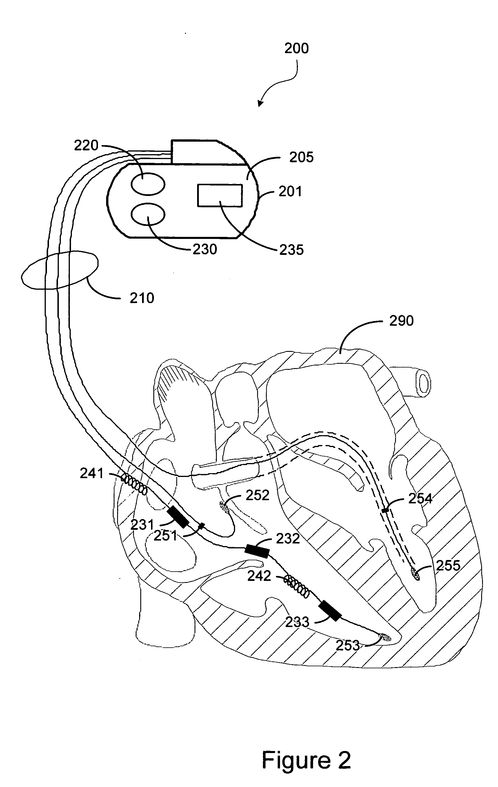 System and method for characterizing patient respiration