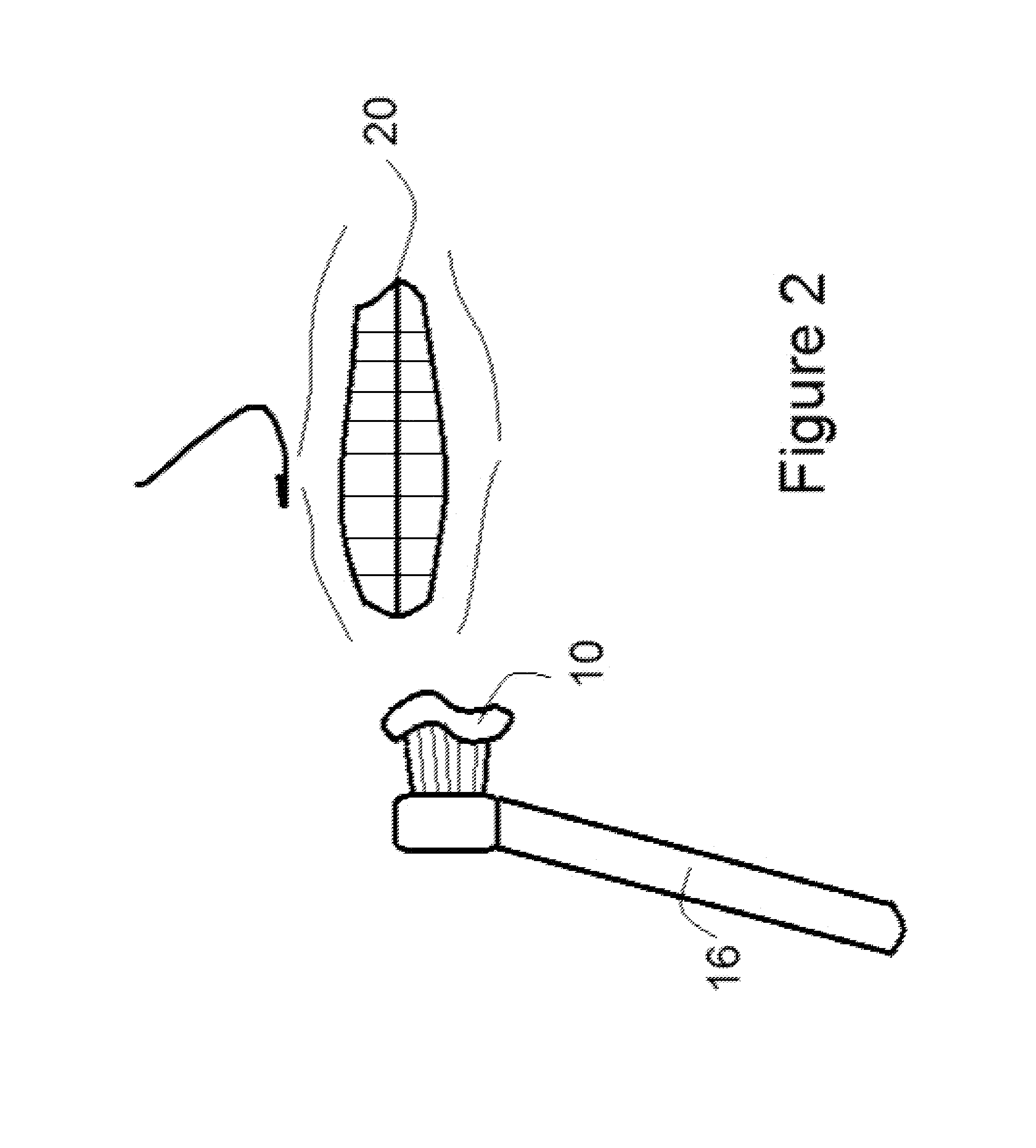 Botanical tooth whitener composition and method for treating discolored or stained teeth