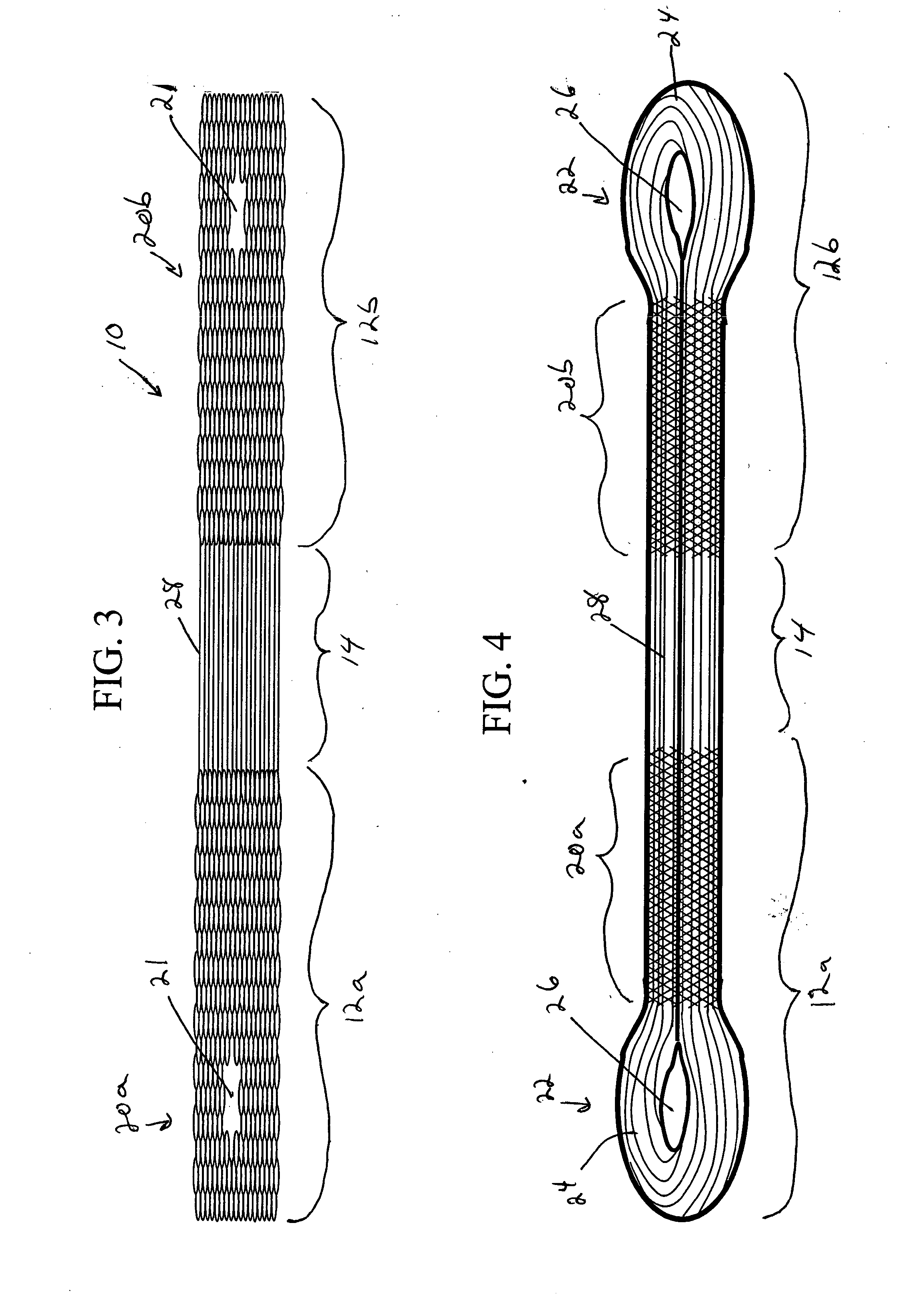 Scaffold for connective tissue repair