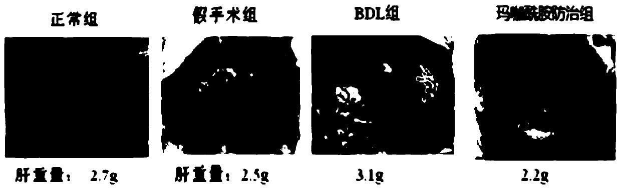Application of macamide compound or salt of macamide compound to preparation of drugs for preventing or treating liver fibrosis diseases