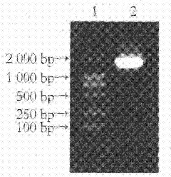 DcR3 (Decoy Receptor 3) and GAD65 (Glutamic Acid Decarboxylase 65) double gene co-expression recombinant adenovirus as well as preparation method and application thereof