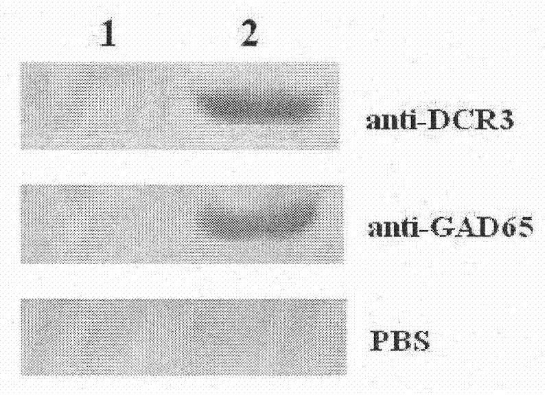 DcR3 (Decoy Receptor 3) and GAD65 (Glutamic Acid Decarboxylase 65) double gene co-expression recombinant adenovirus as well as preparation method and application thereof