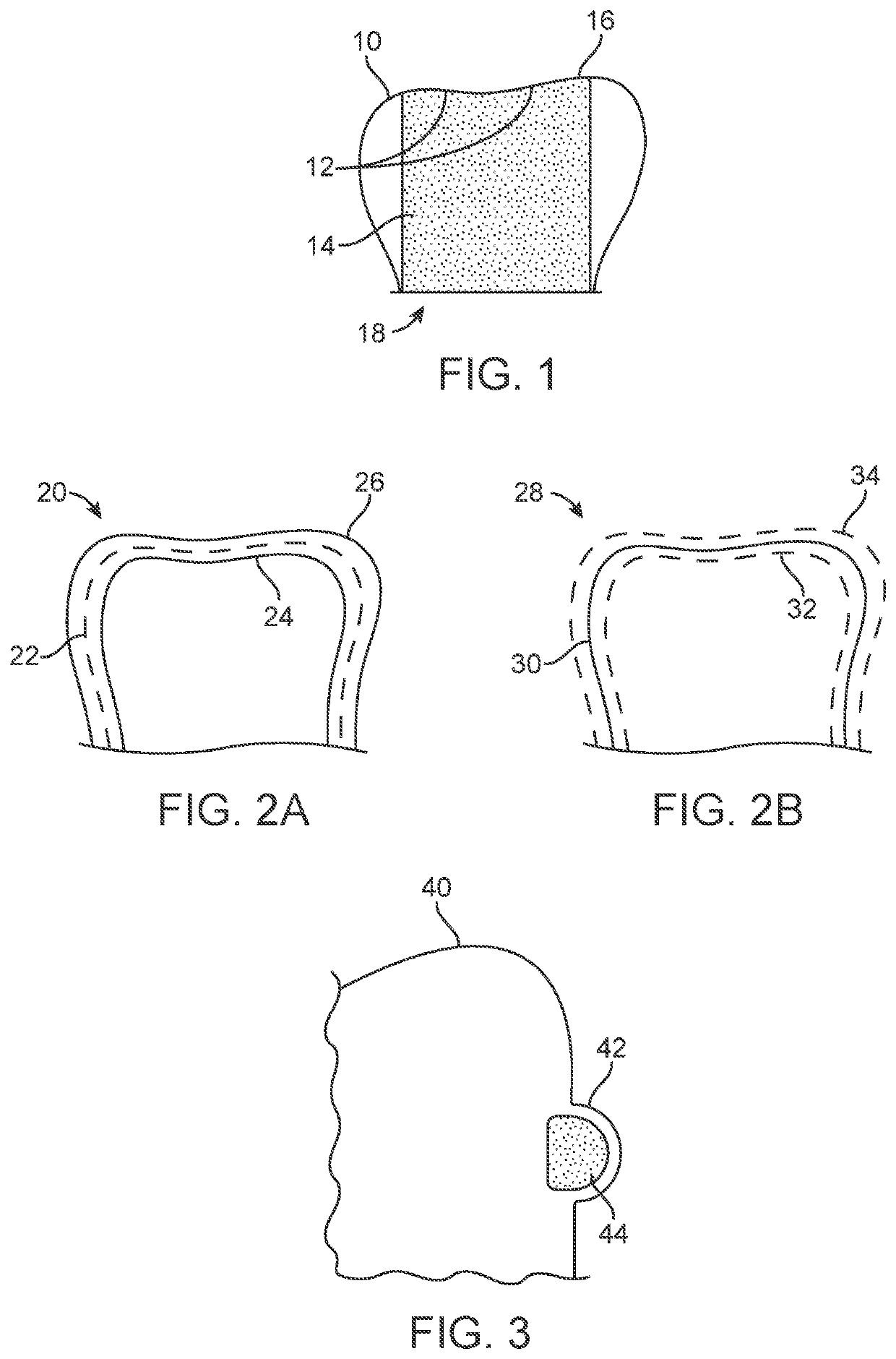 Three-dimensional printed dental appliances using support structures