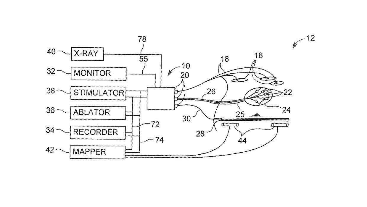 Coordinating interface for electrophysiology studies