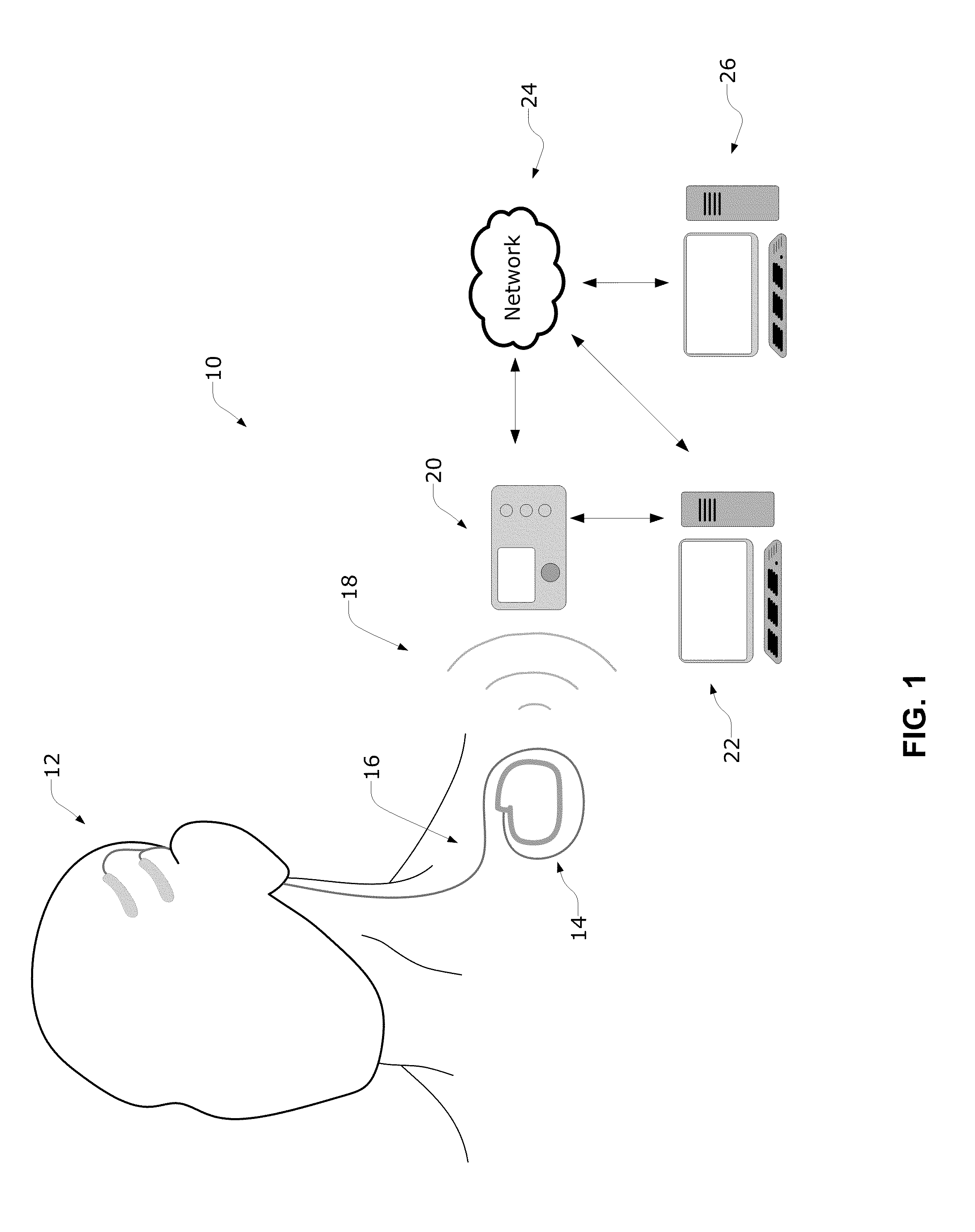 Communication Error Alerting in an Epilepsy Monitoring System