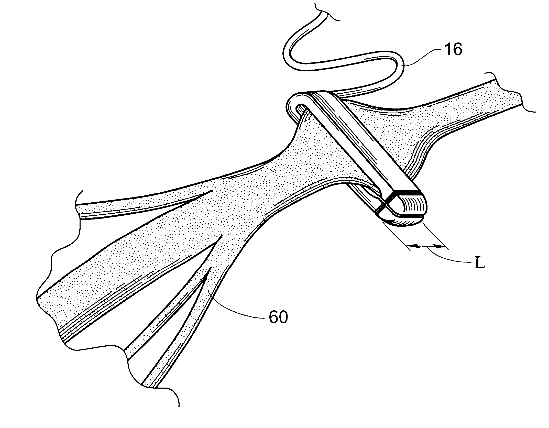 Flat interface nerve electrode and a method for use