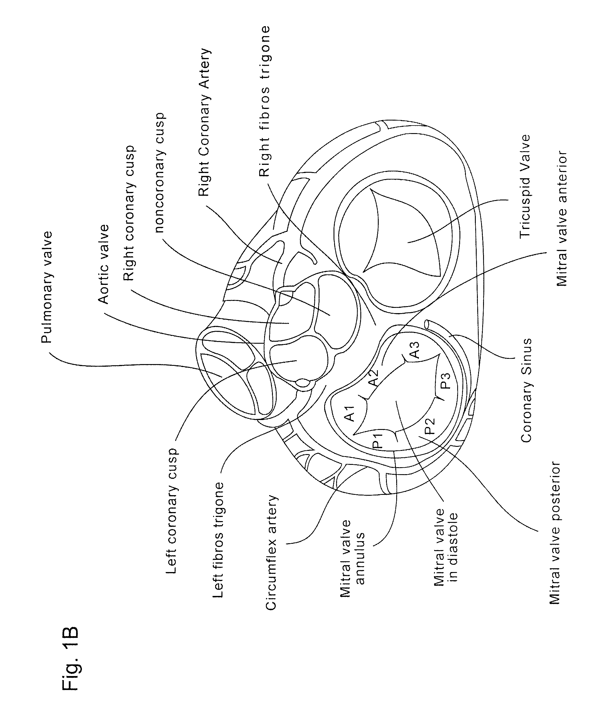 Coaptation enhancement implant, system, and method