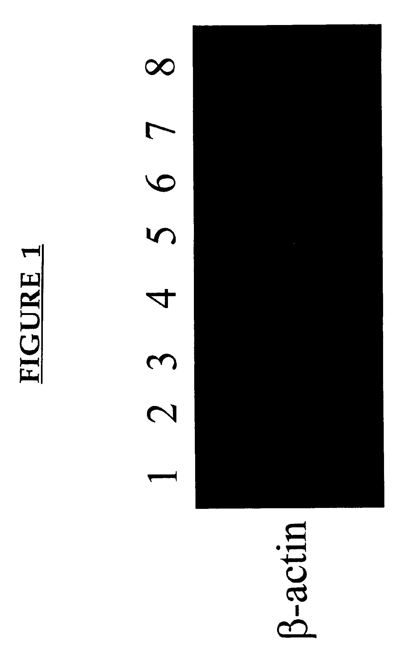 Methods of inhibiting immune response suppression by administering antibodies to OX-2
