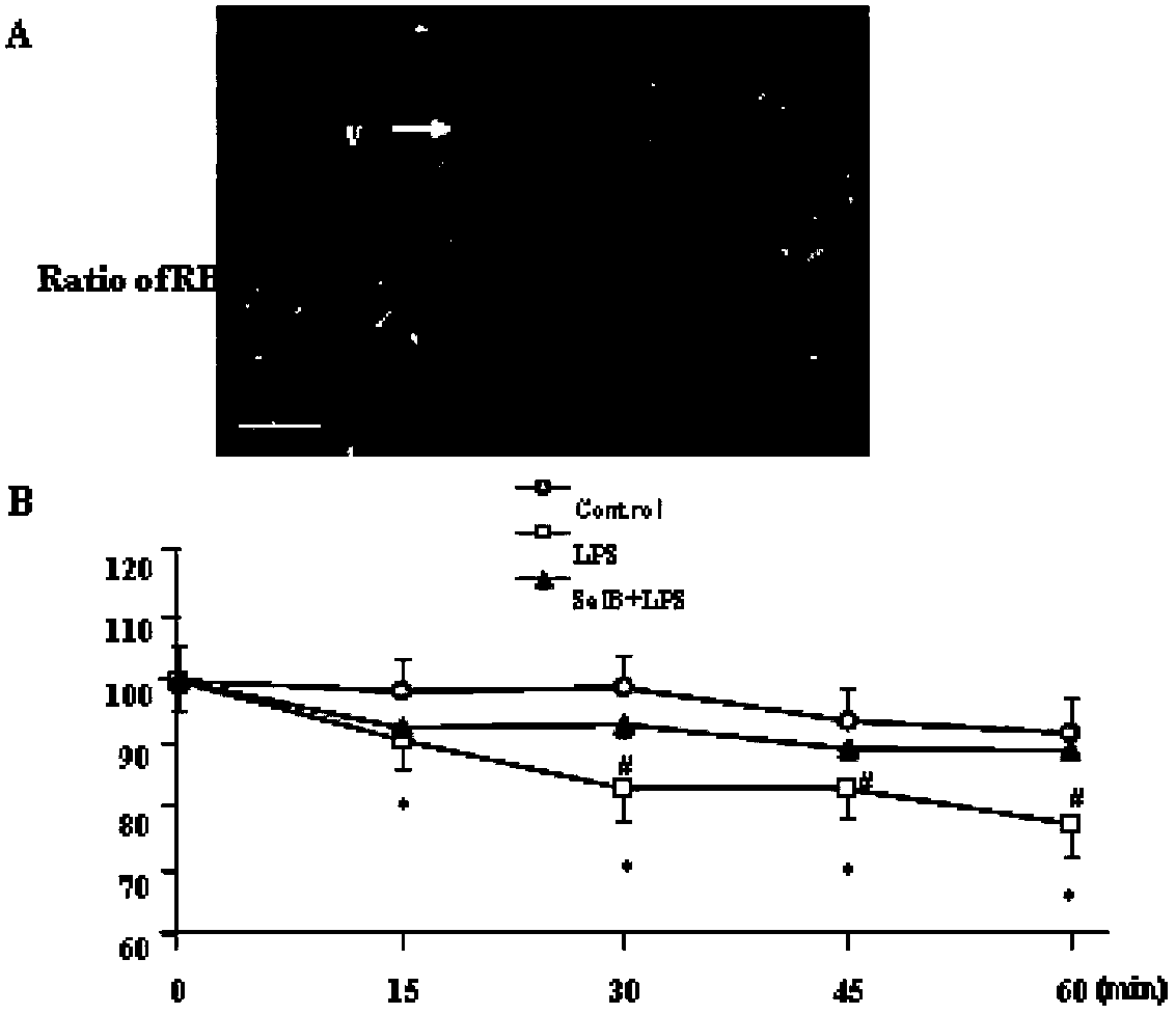 Application of salvianolic acid B to preparation of medicament for prevention and / or treatment of pulmonary microcirculation disorder or lung injury