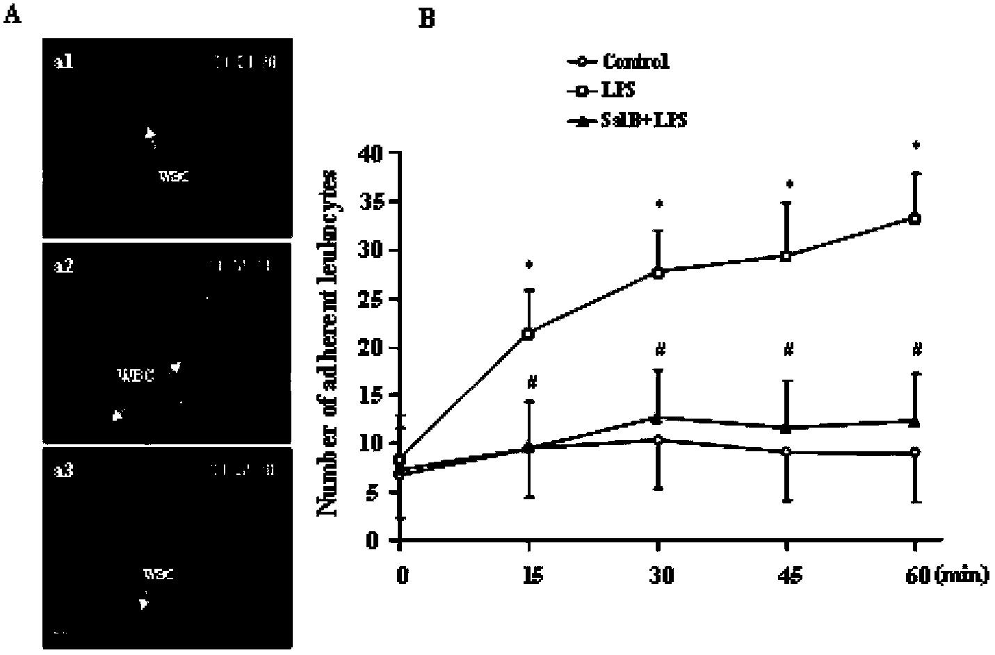 Application of salvianolic acid B to preparation of medicament for prevention and / or treatment of pulmonary microcirculation disorder or lung injury