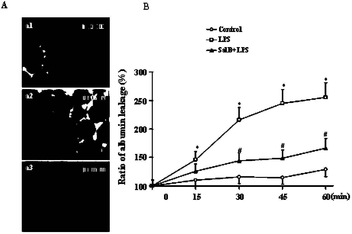 Application of salvianolic acid B to preparation of medicament for prevention and / or treatment of pulmonary microcirculation disorder or lung injury