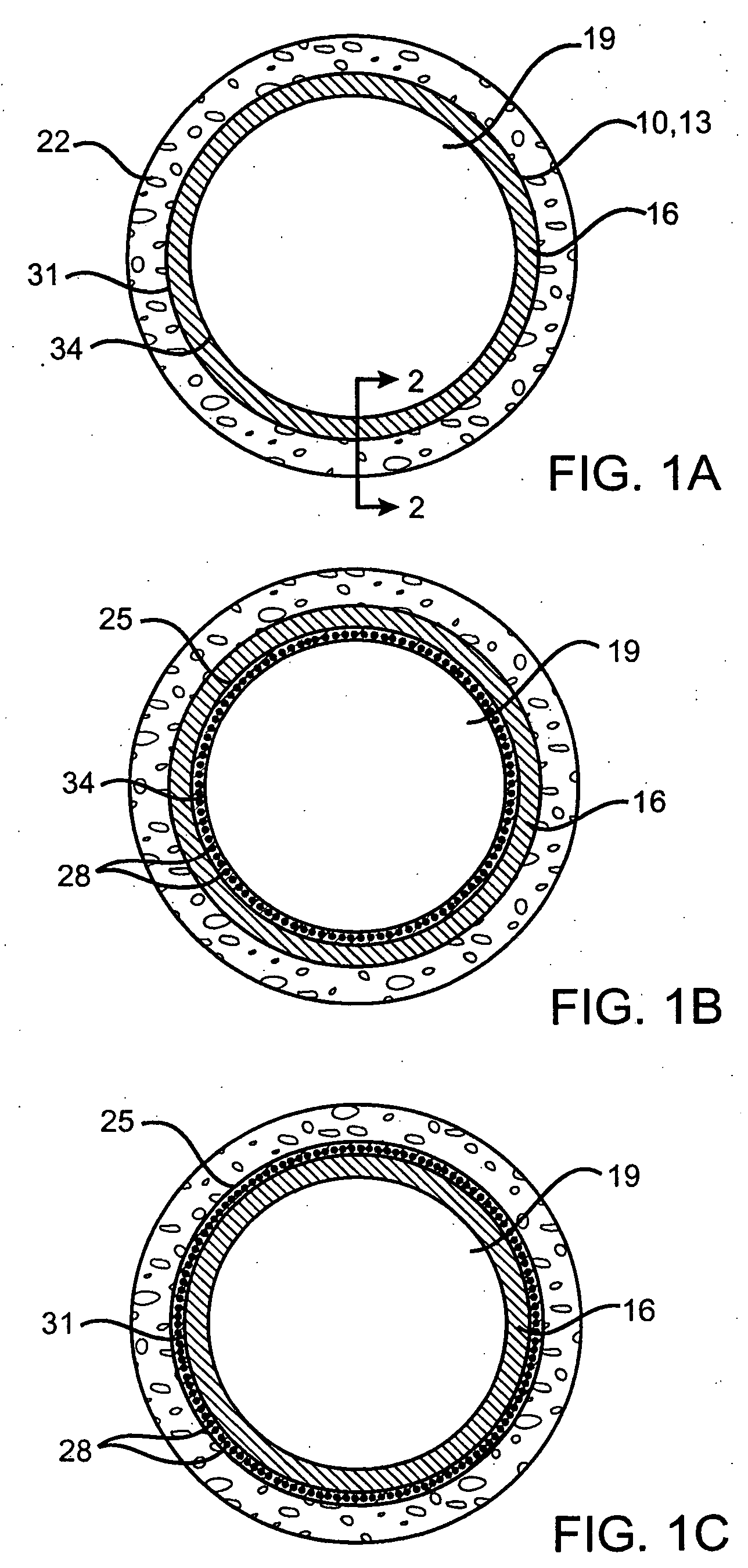 Devices delivering therapeutic agents and methods regarding the same