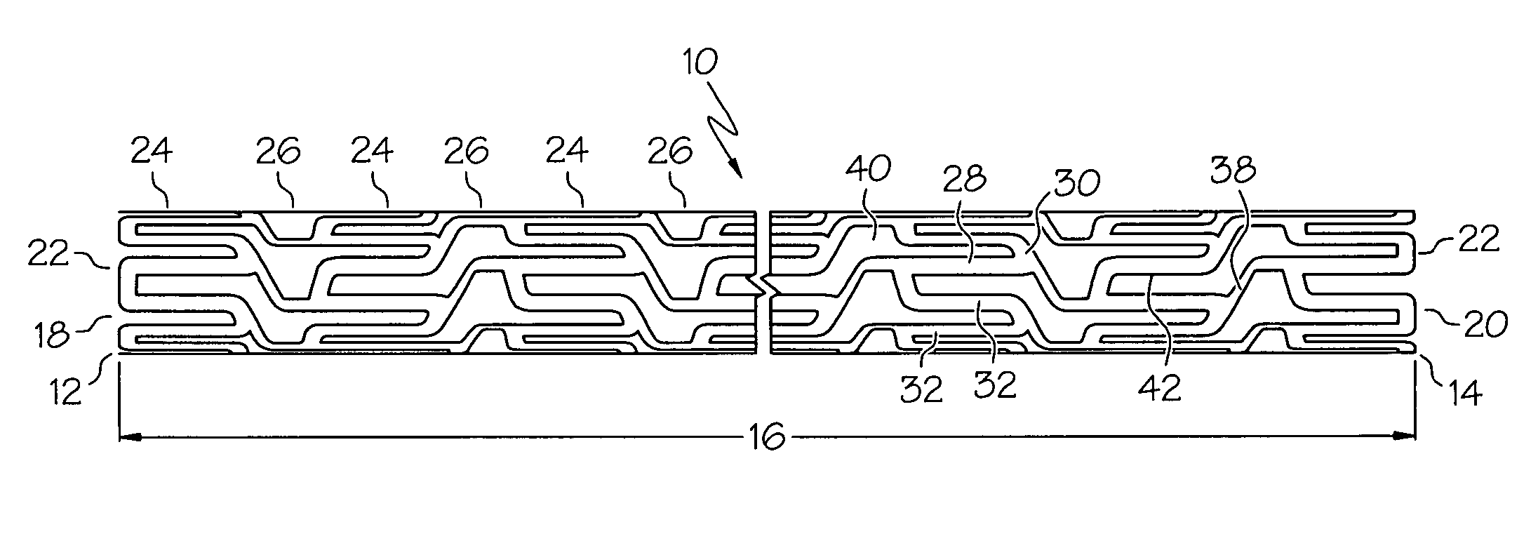 Intravascular stent