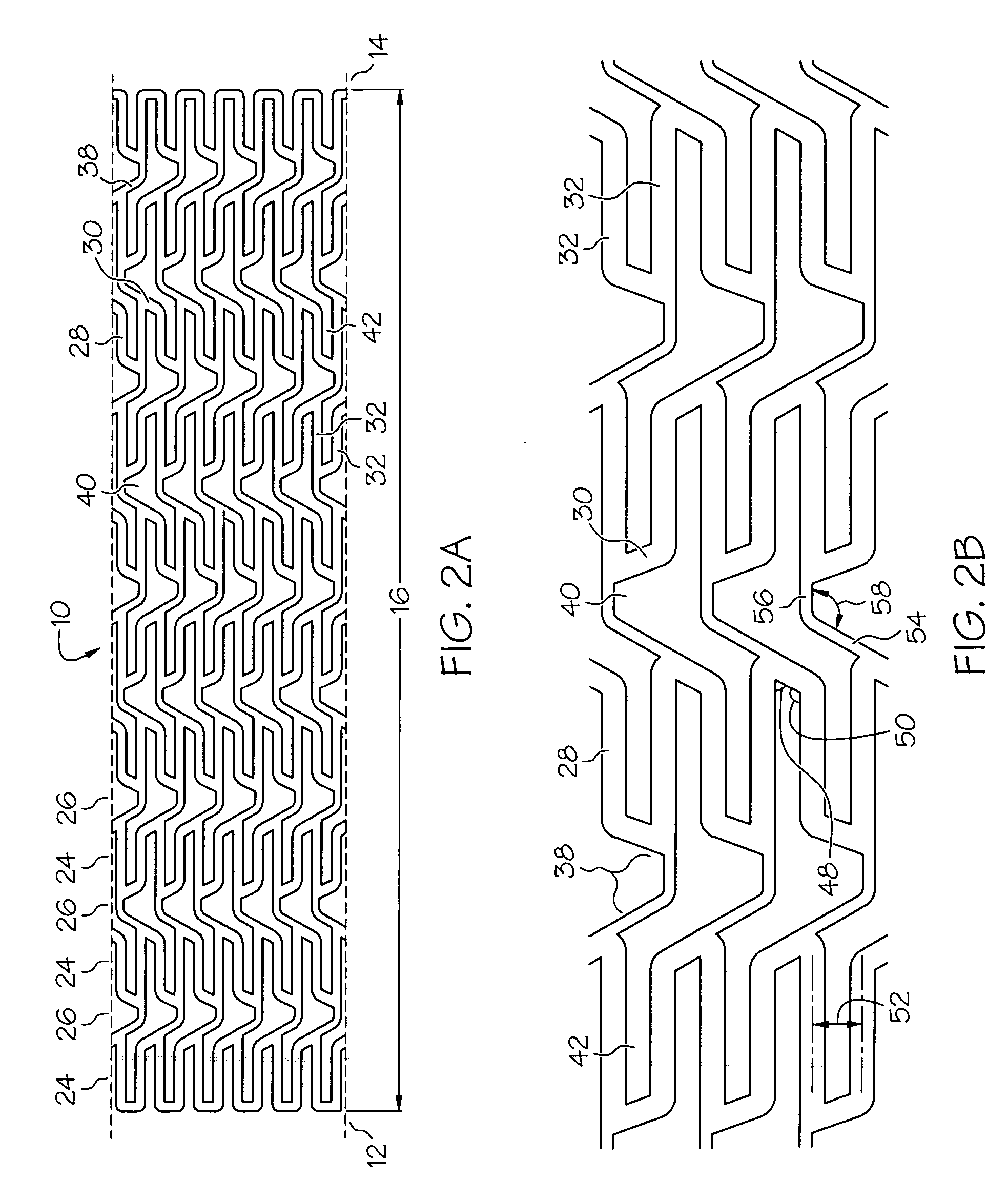 Intravascular stent