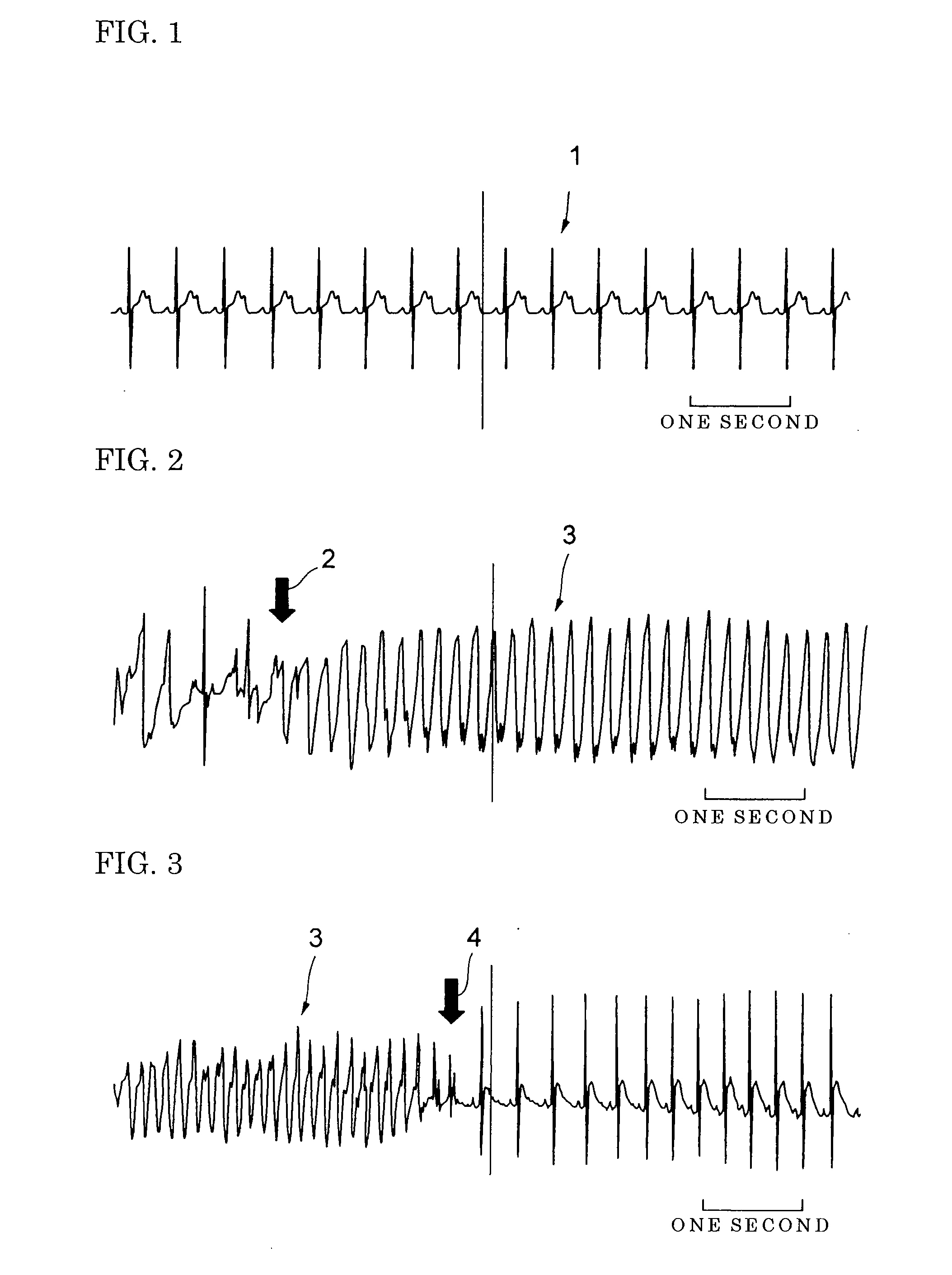 Muscle Relaxtion Accelerator and Therapeutic Agent for Muscular Tissue Diseases Such as Muscle Relaxation Failure