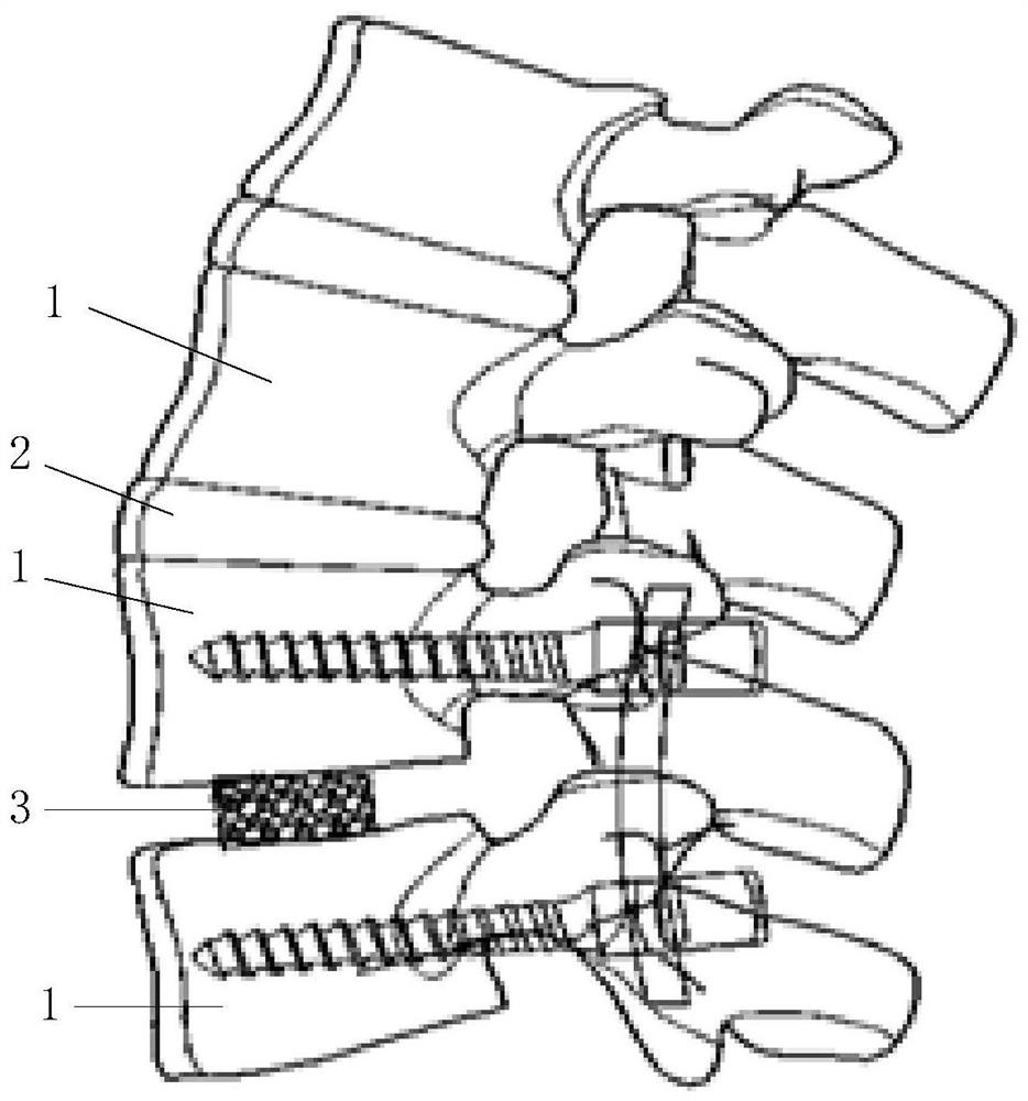 Interbody fusion cage