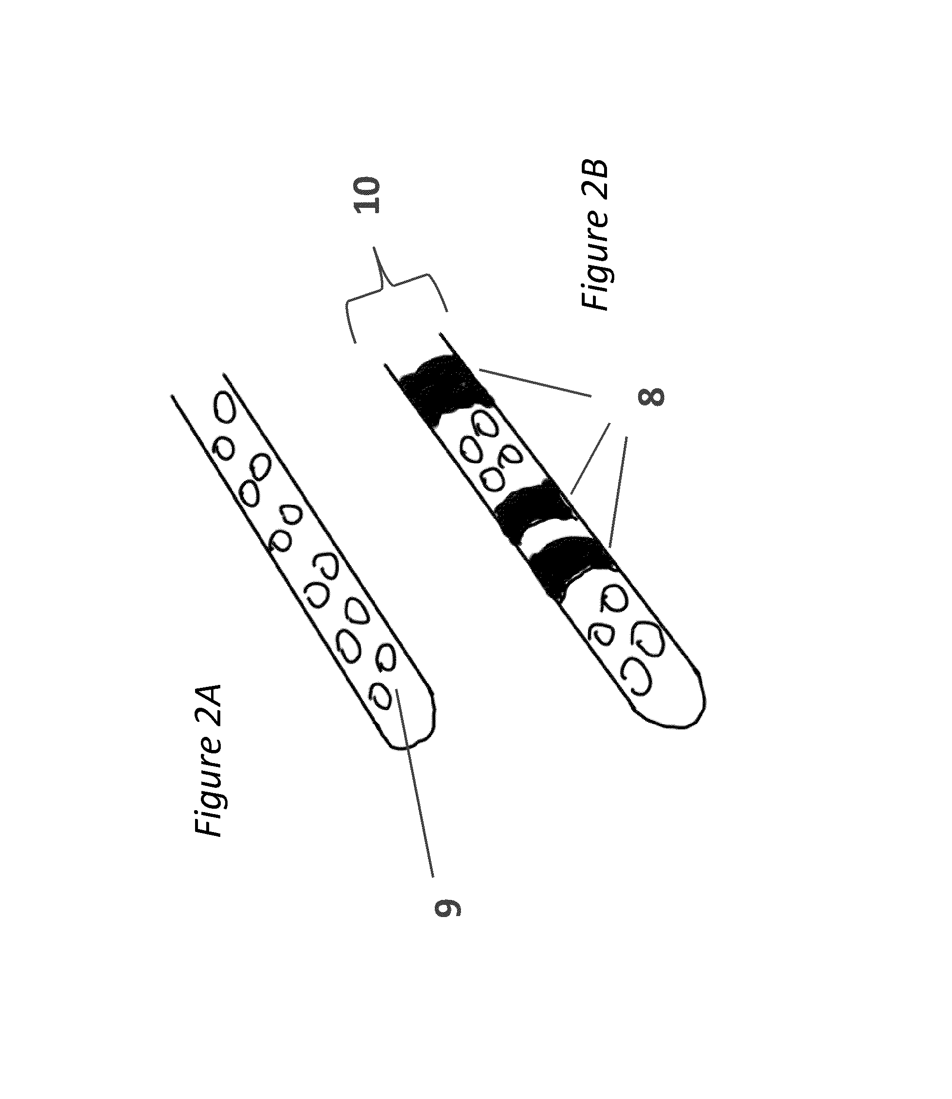 Methods and systems for intraventricular brain stimulation