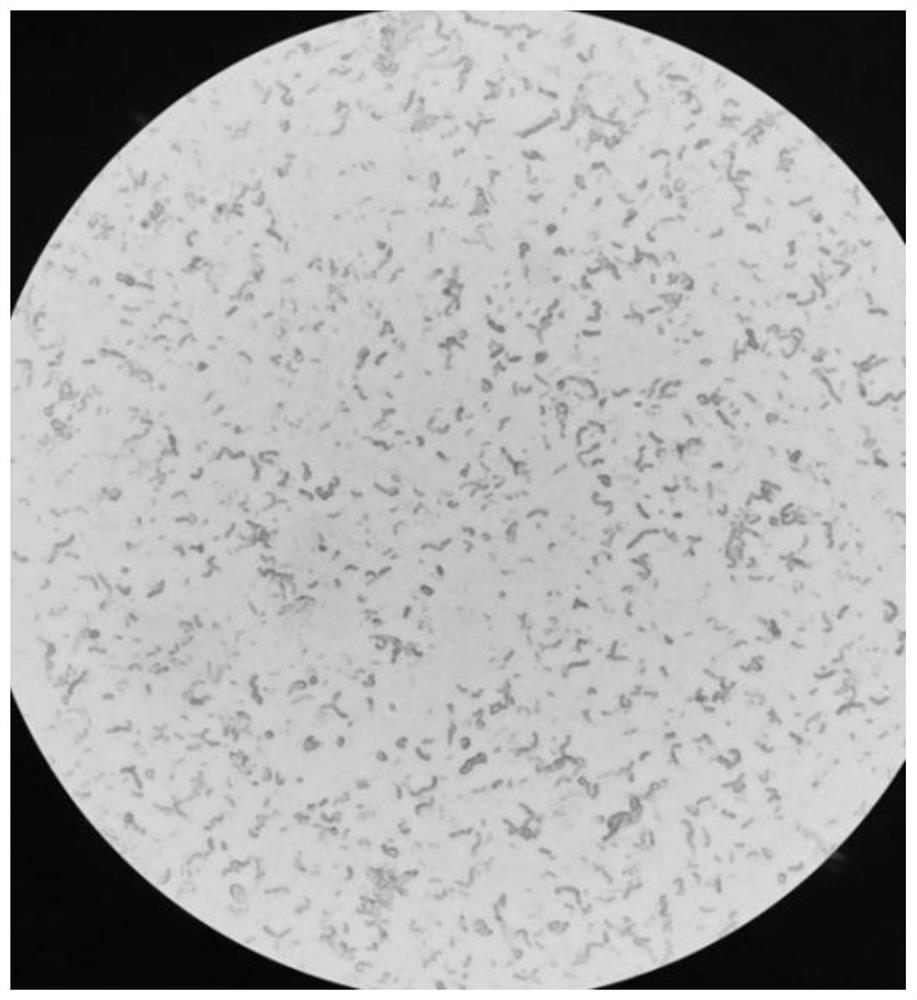 Neosphingosine arerophile, thallus preparation, intracellular enzyme preparation and application of neosphingosine arerophile in degradation of microcystic toxins