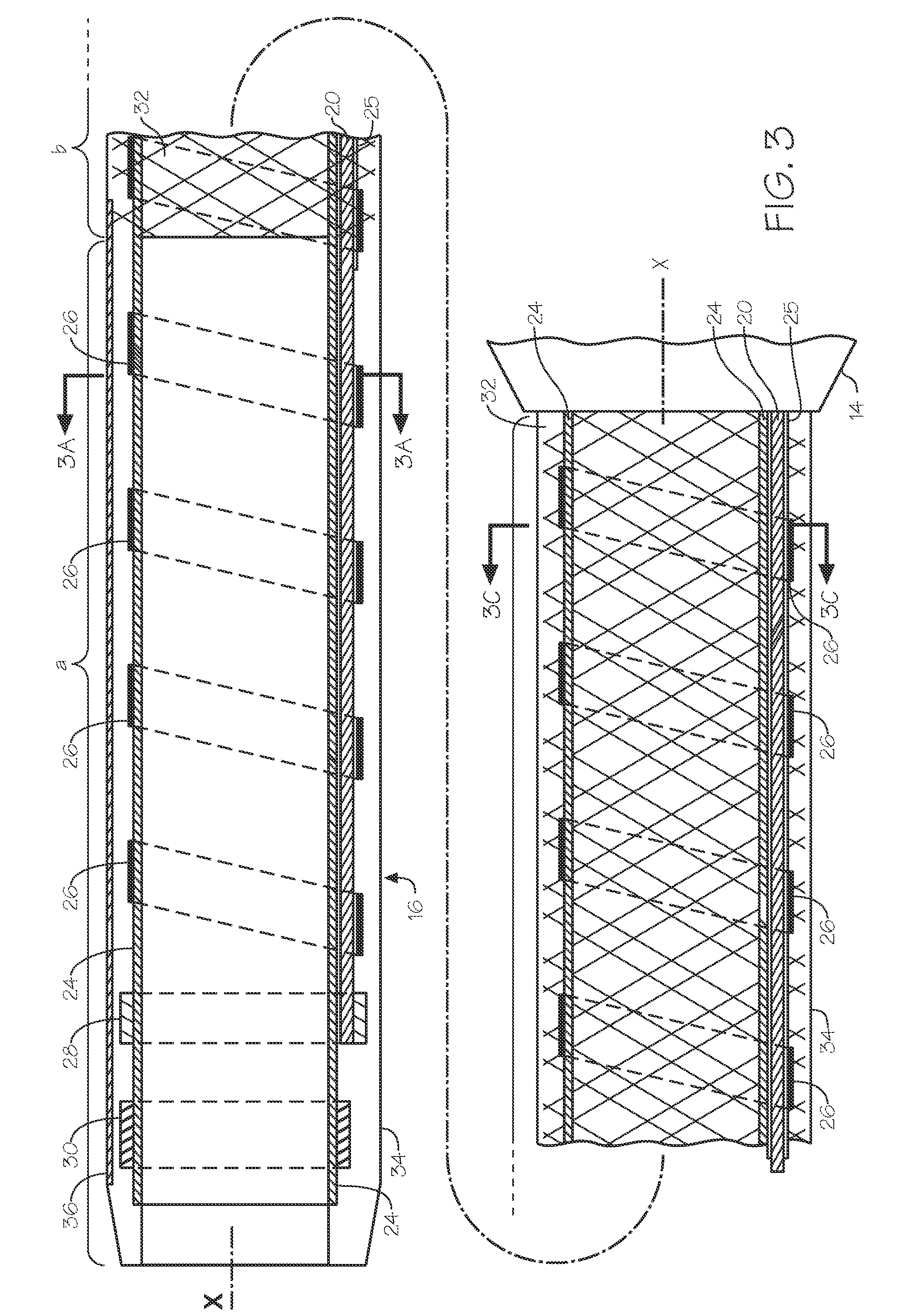 Steerable endoluminal devices and methods