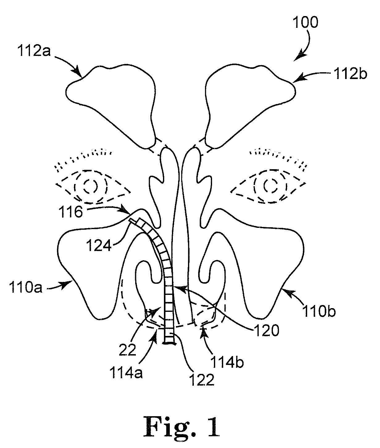 Solvating system and sealant for medical use in the sinuses and nasal passages