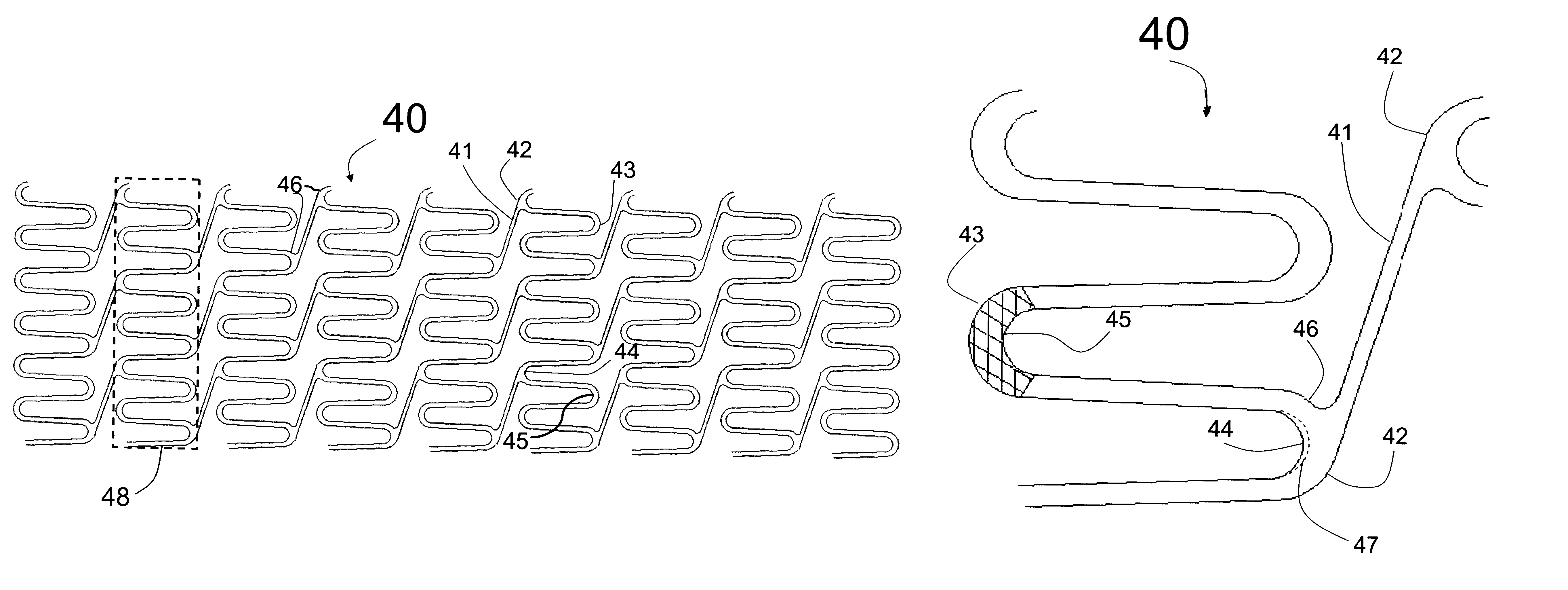 Hybrid stent with helical connectors