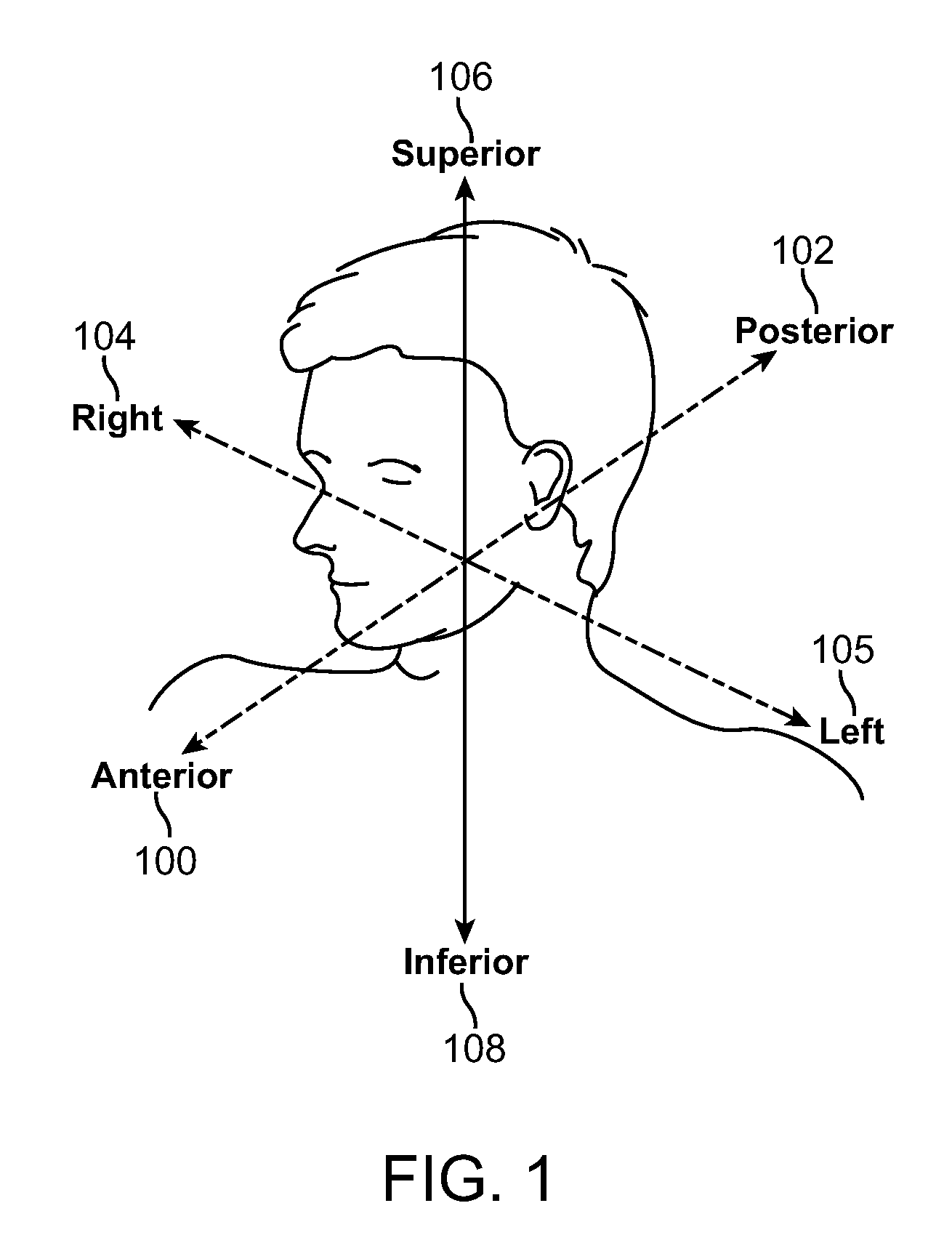 Delivery tools for sleep disorders treatment implant and methods of implantation