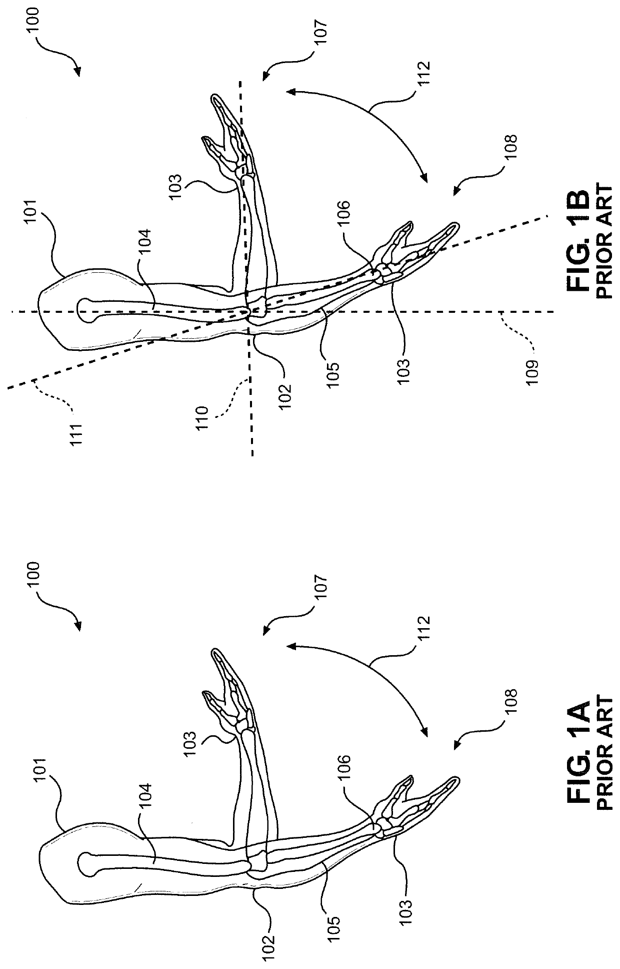 Device and Method for Strengthening the Arms of Human Exoskeletons