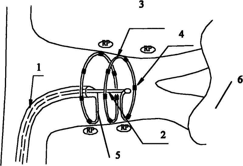 Retractable spiral laminar ring type electrode catheter