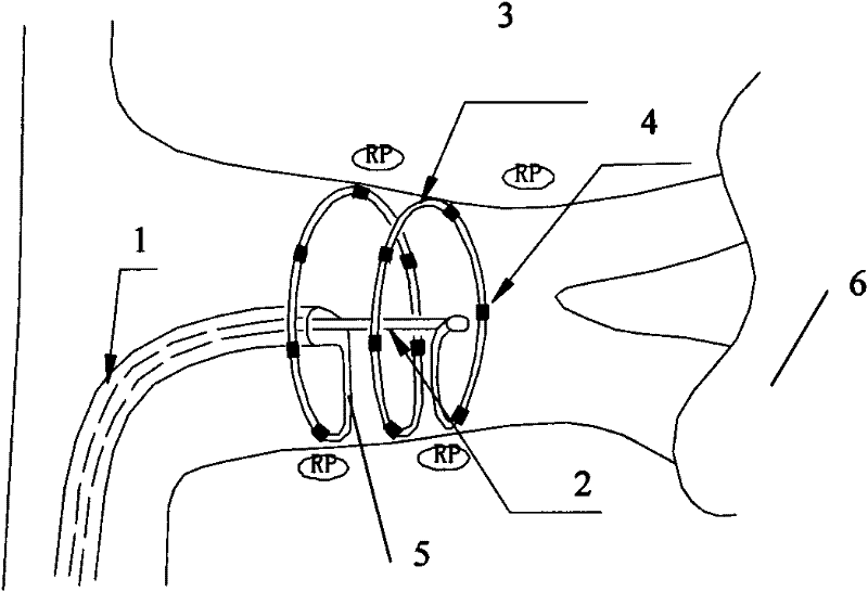 Retractable spiral laminar ring type electrode catheter