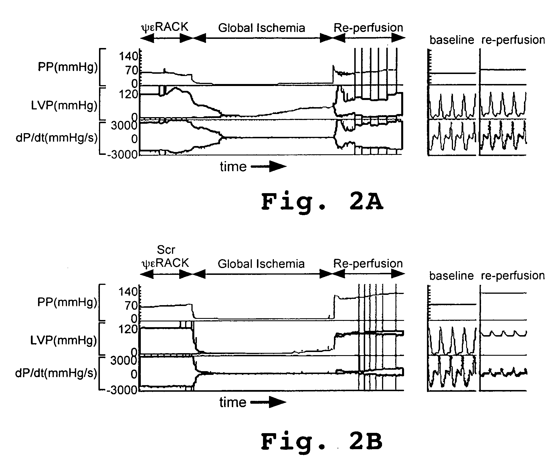 ΨεRACK peptide composition and method for protection against tissue damage due to ischemia