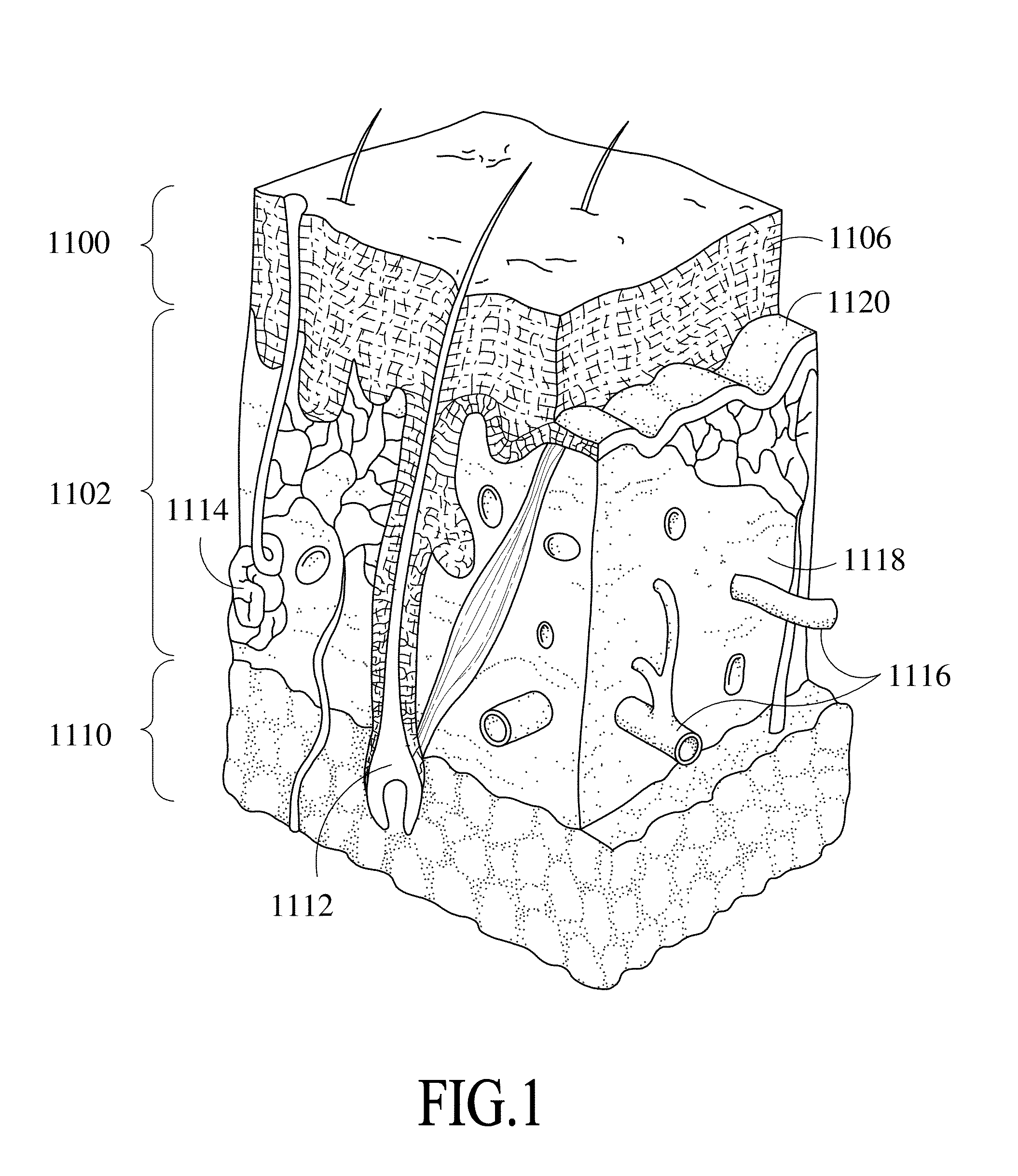 Apparatus and Method for Treatment of Microbial Infection