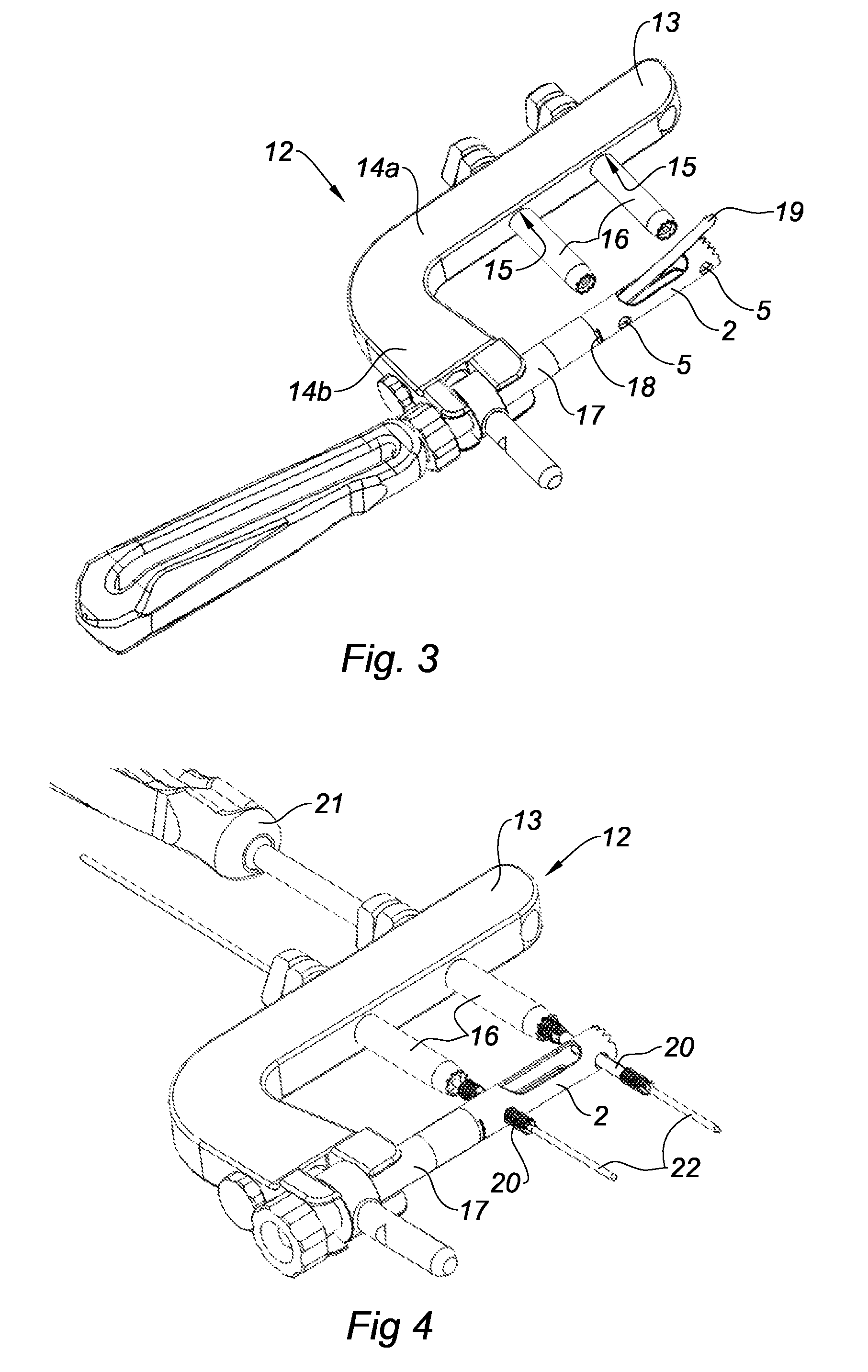 Osteosynthesis pin