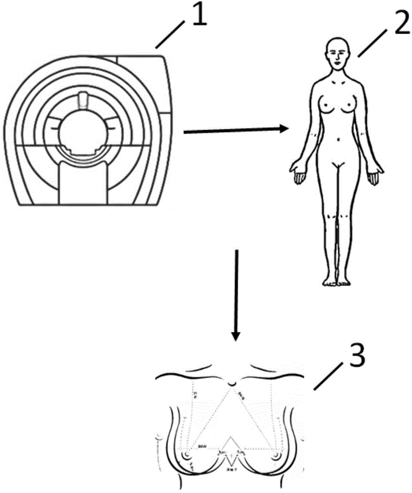 Breast prosthesis manufacturing method based on three-dimensional printing technology