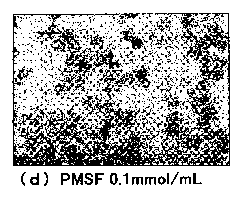 Method for detecting and identifying microorganism causative of infection