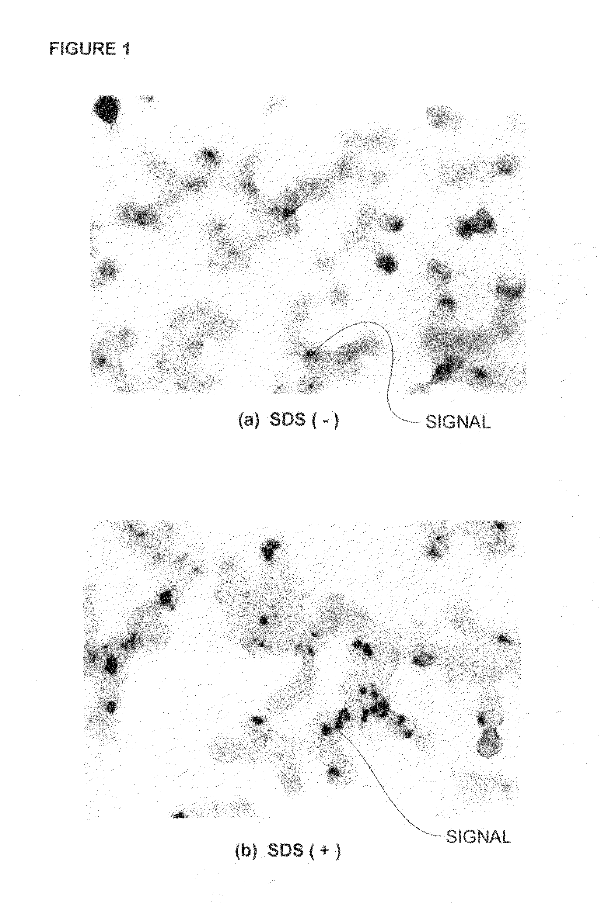 Method for detecting and identifying microorganism causative of infection