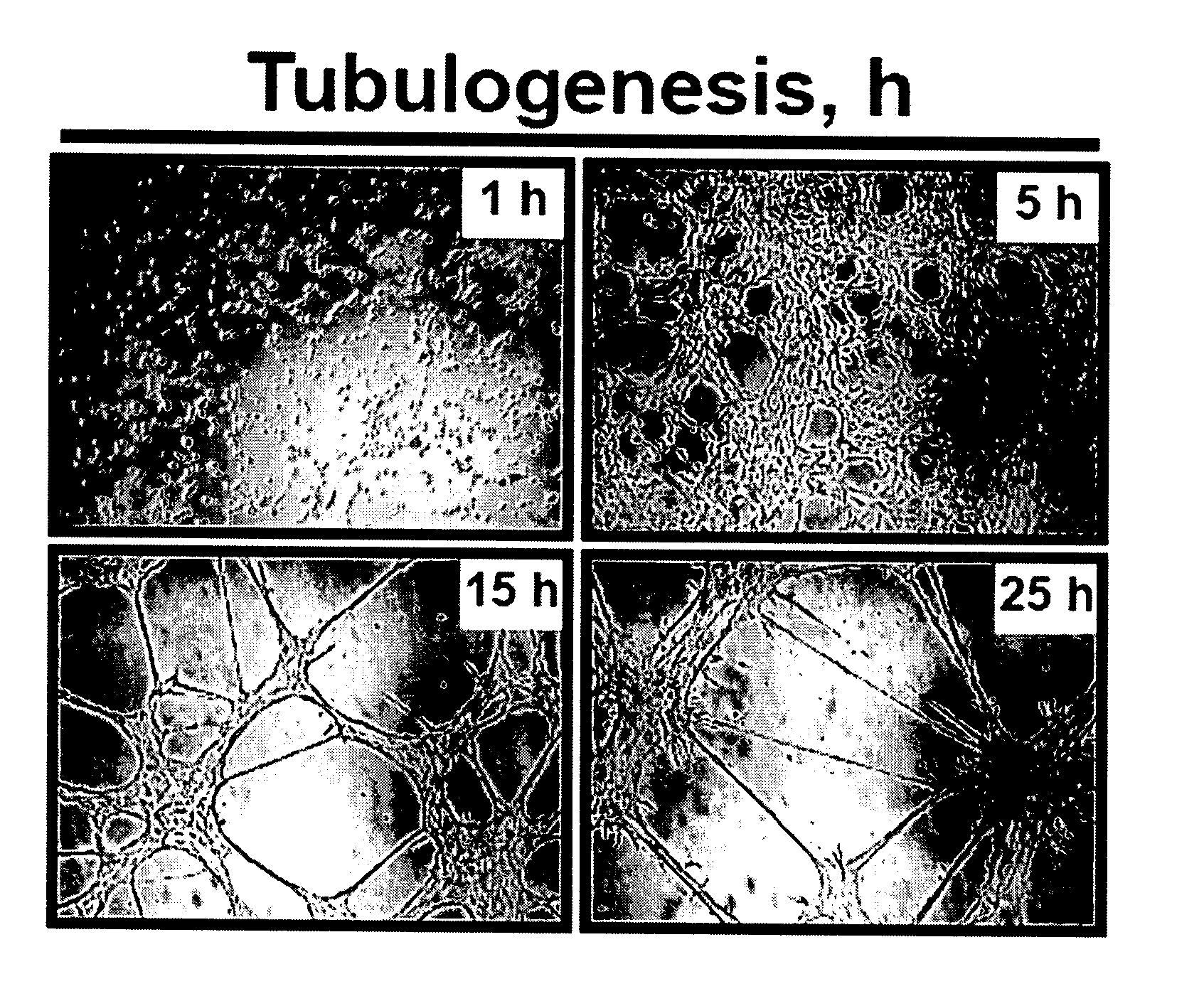 Genes and proteins associated with angiogenesis and uses thereof