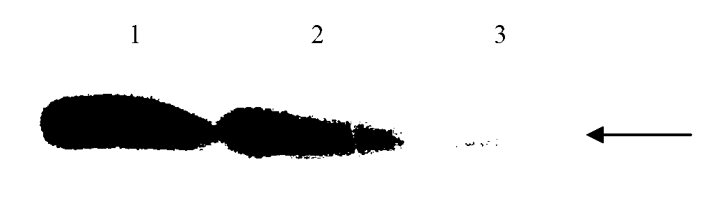 Monoclonal antibody against human neurofilament medium molecular weight subunit and preparation method and application thereof