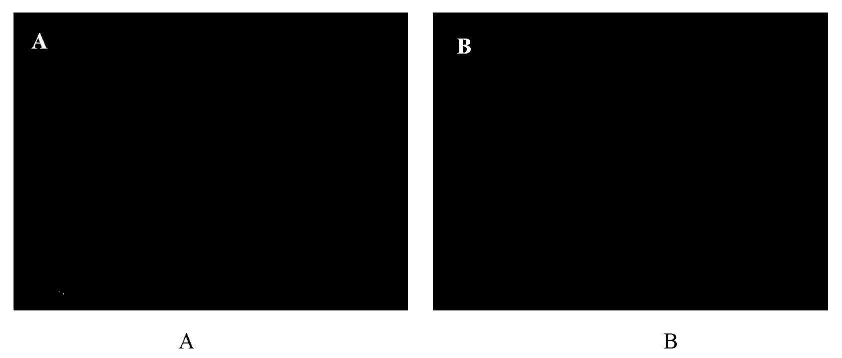 Monoclonal antibody against human neurofilament medium molecular weight subunit and preparation method and application thereof