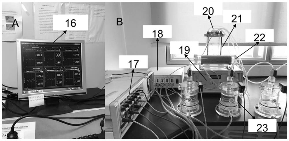 A method of establishing and detecting the establishment and detection method of a mouse model of eosinophilic bronchitis